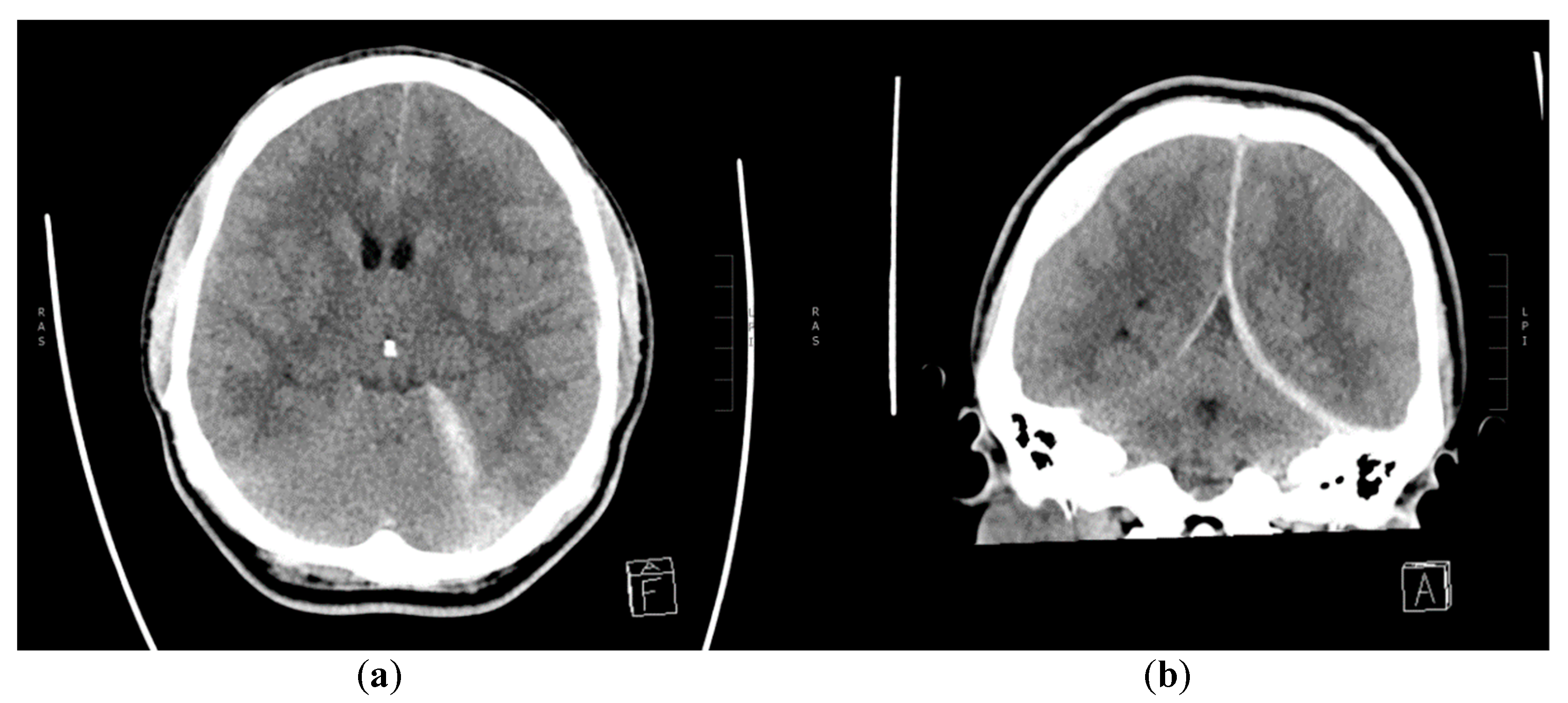 Diagnostics 10 00175 g001