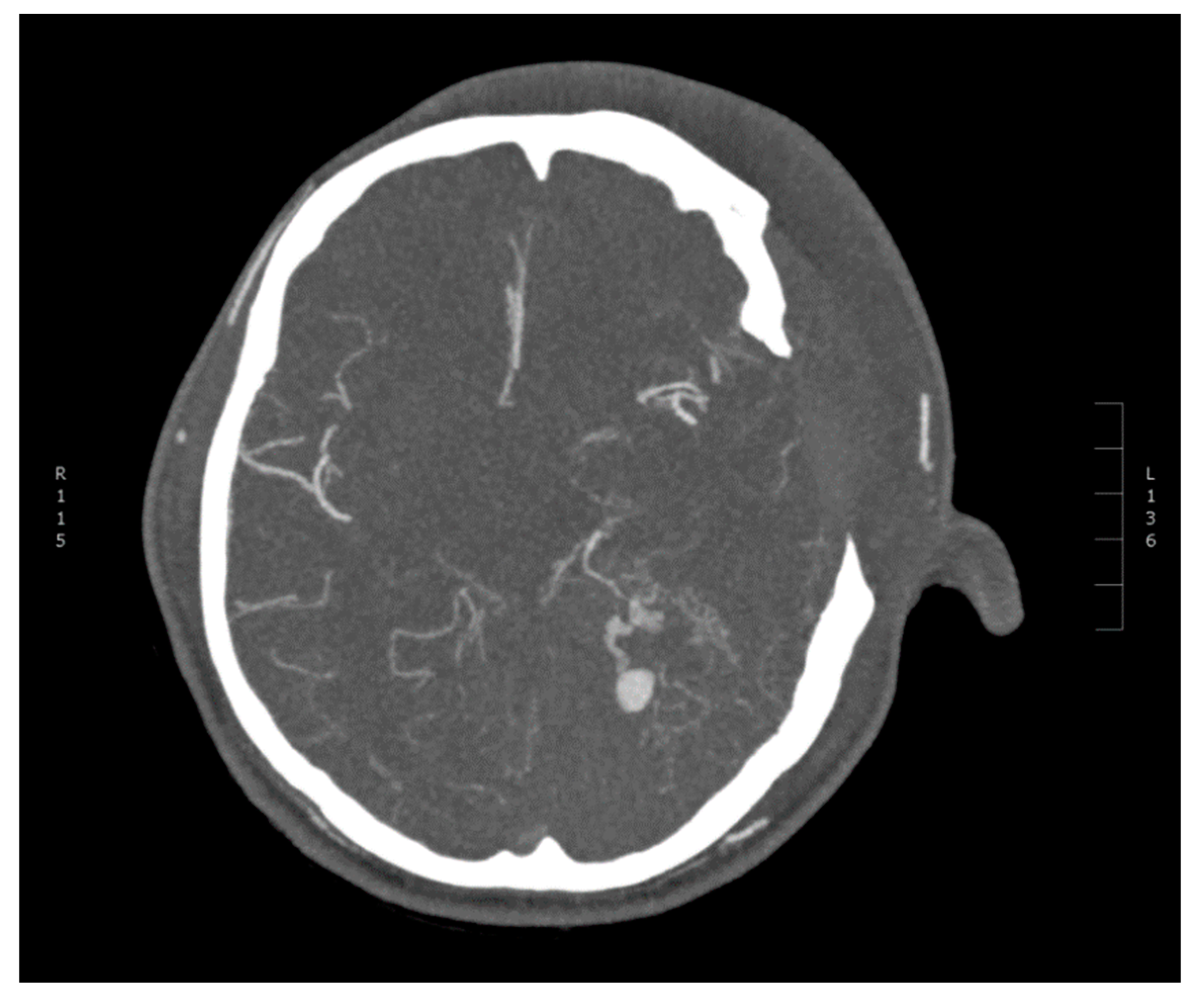 Diagnostics 10 00175 g003