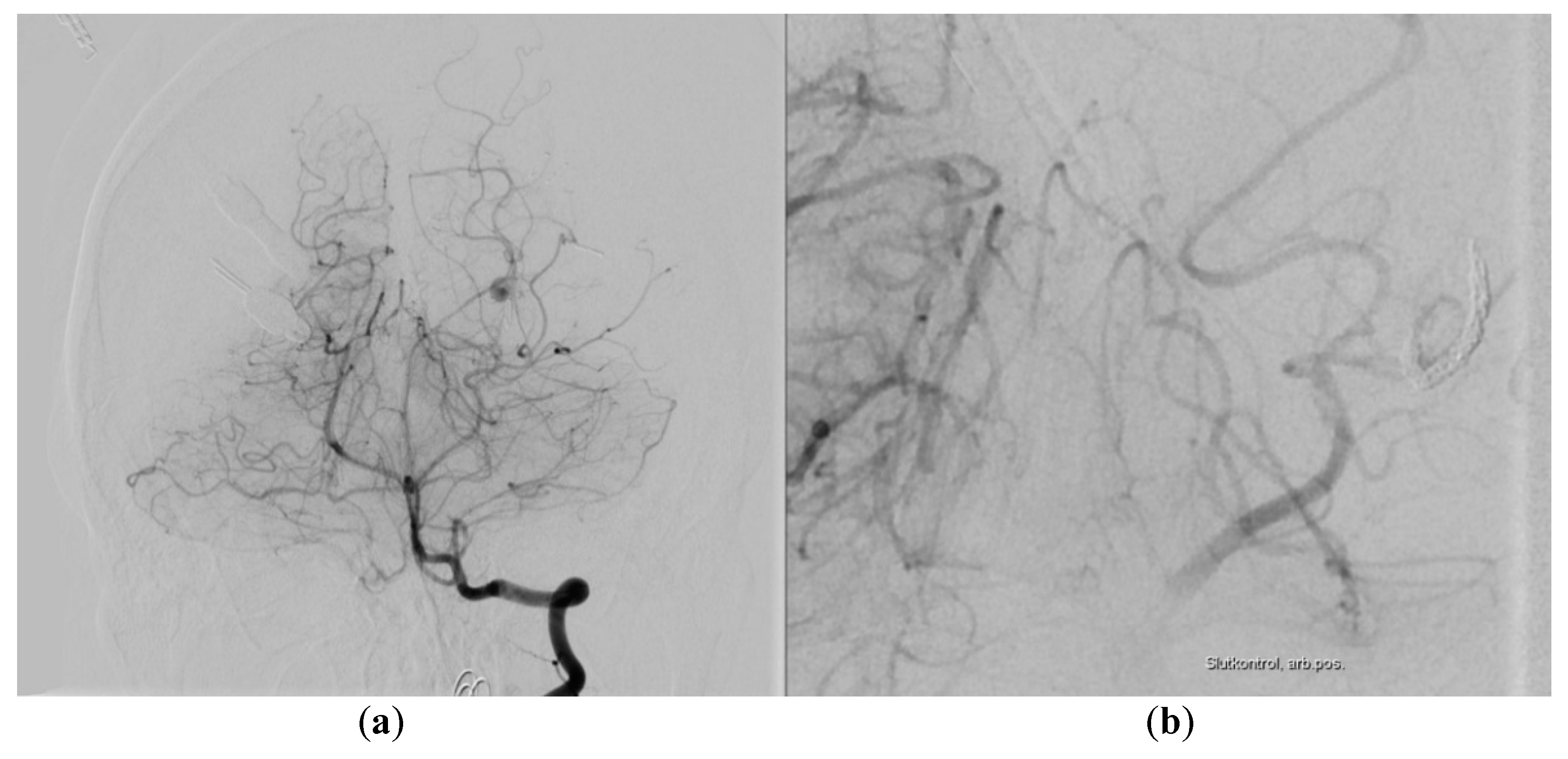 Diagnostics 10 00175 g004