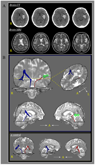 Diagnostics 10 00220 g001