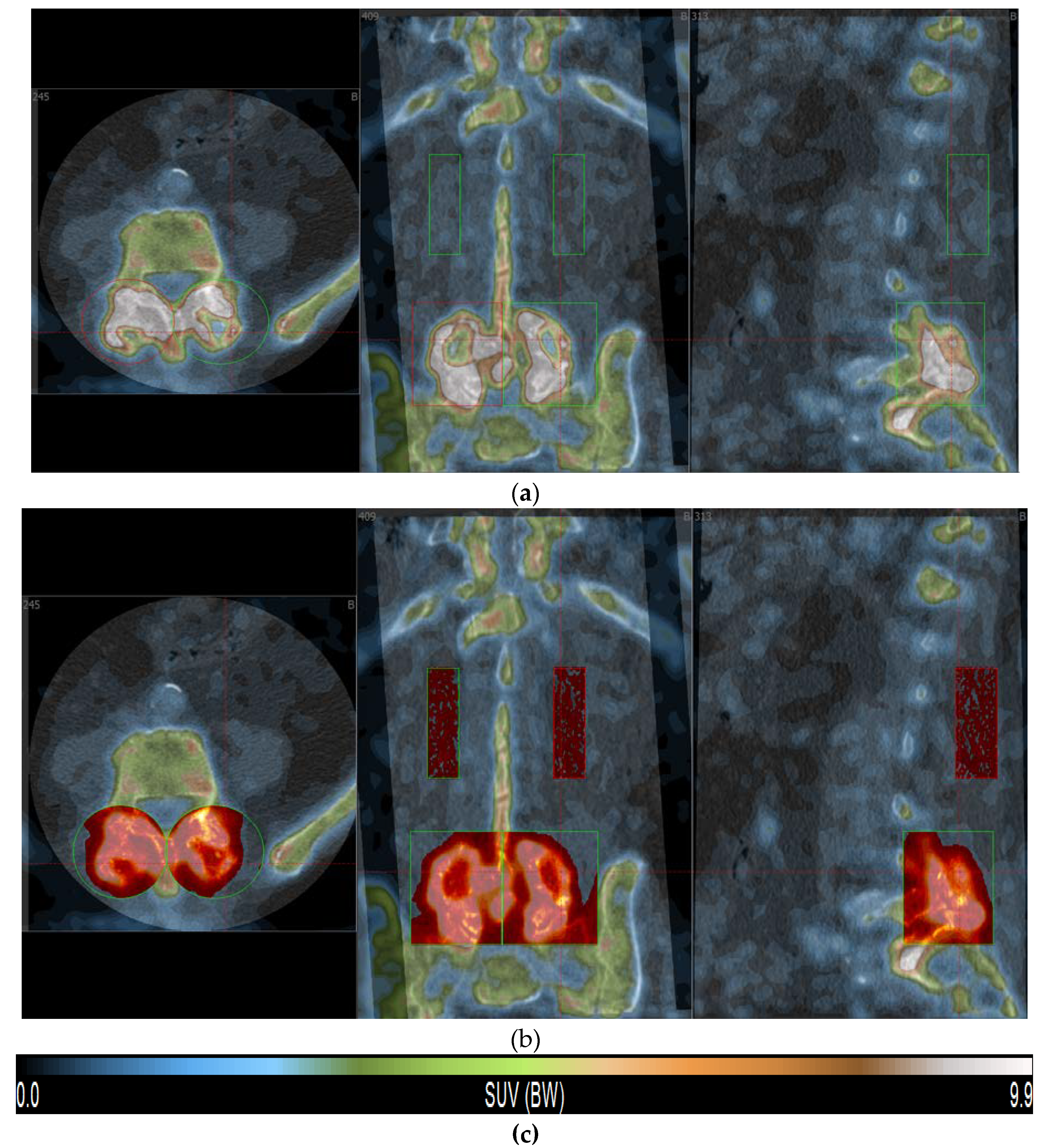 Diagnostics 10 00226 g001