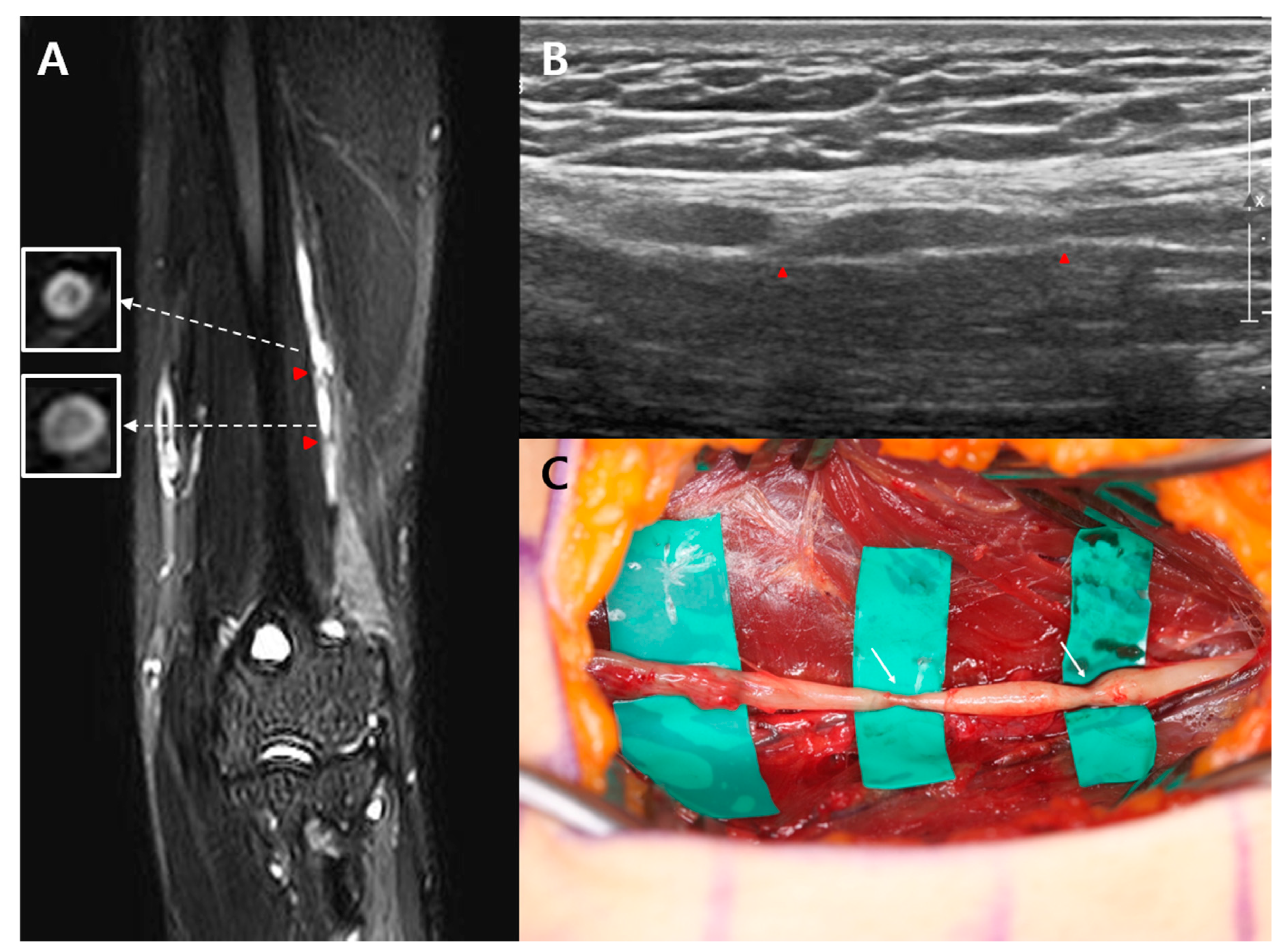 Diagnostics 10 00232 g002