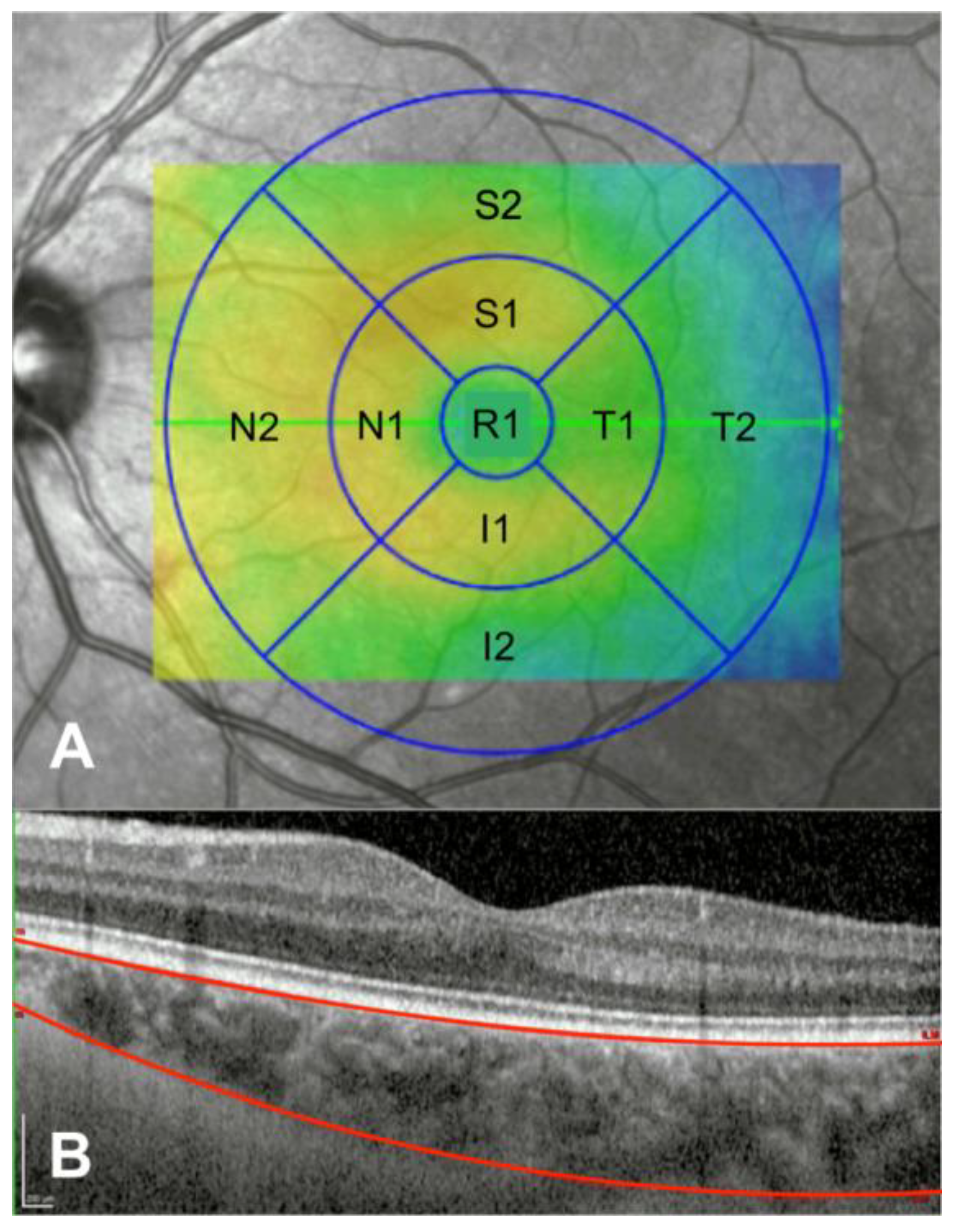 Diagnostics 10 00235 g001