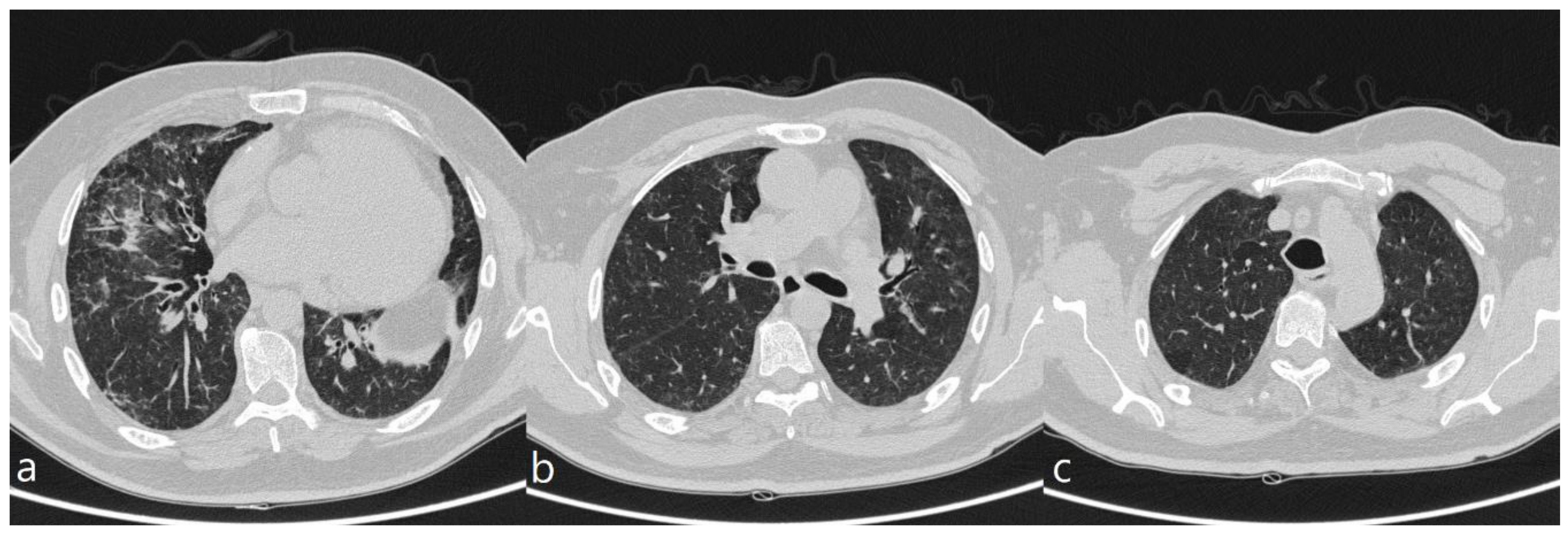 Diagnostics 10 00244 g001