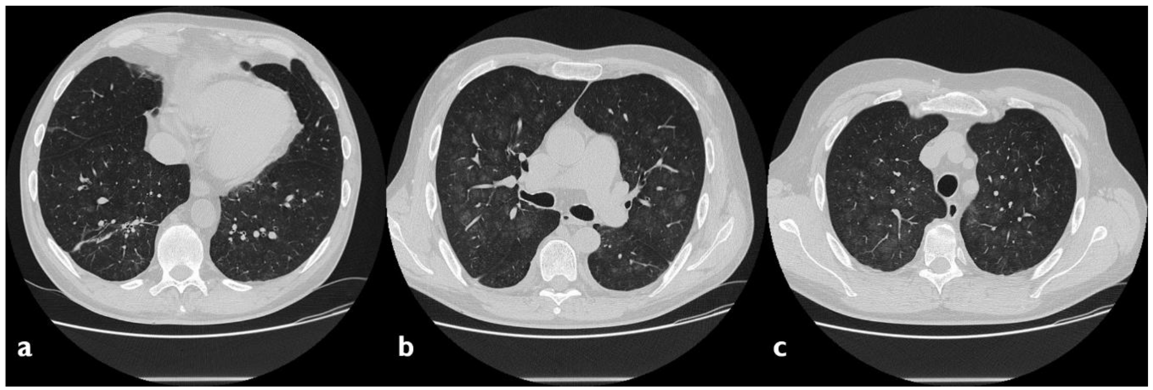 Diagnostics 10 00244 g002