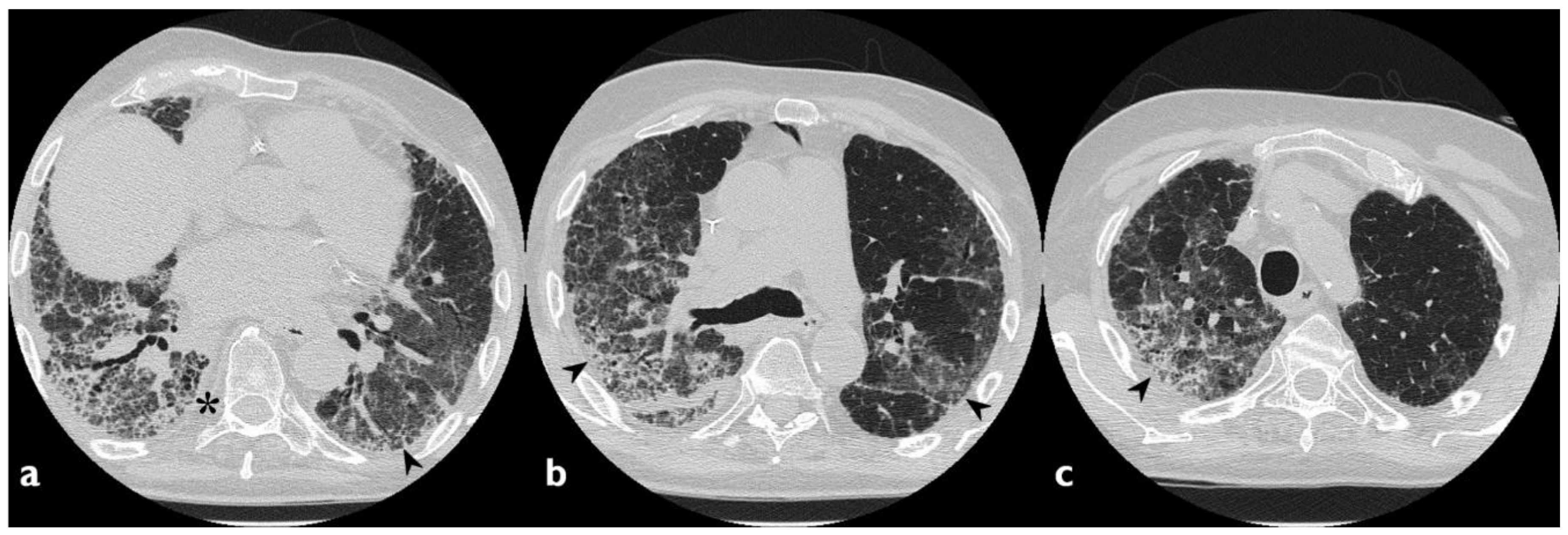 Diagnostics 10 00244 g004