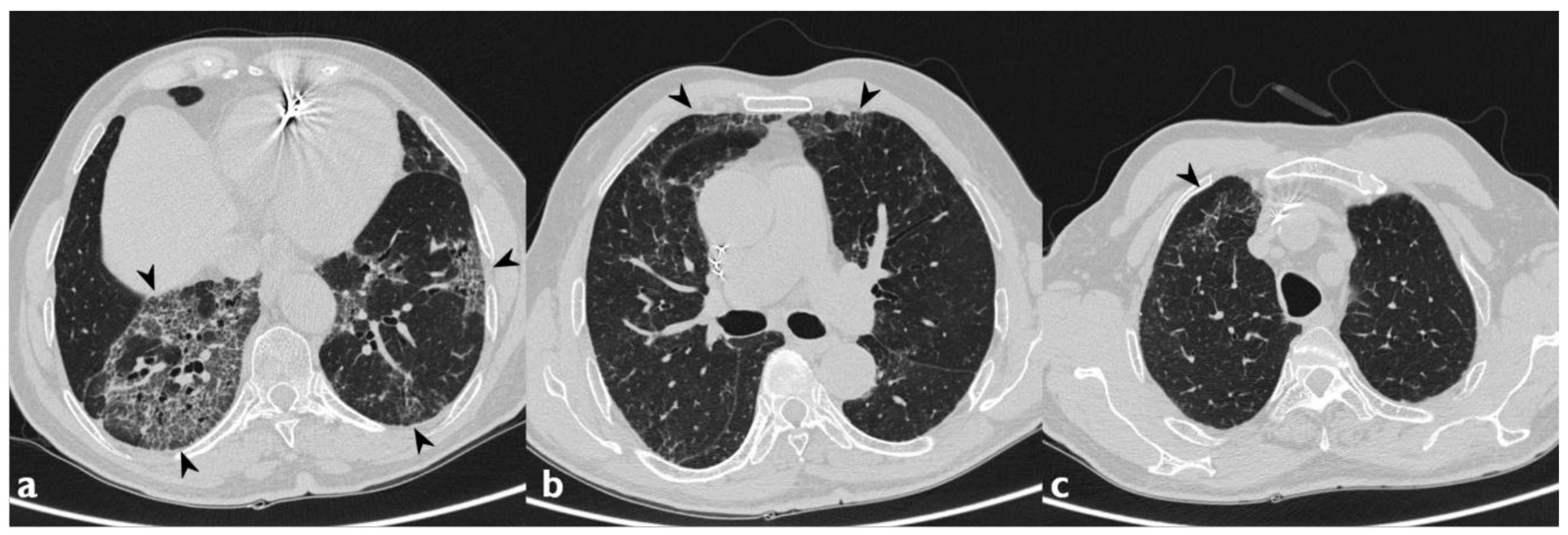 Diagnostics 10 00244 g005