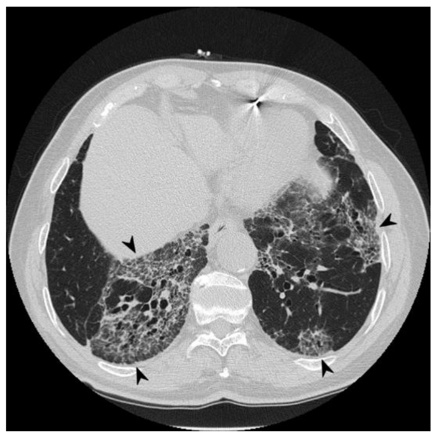 Diagnostics 10 00244 g006