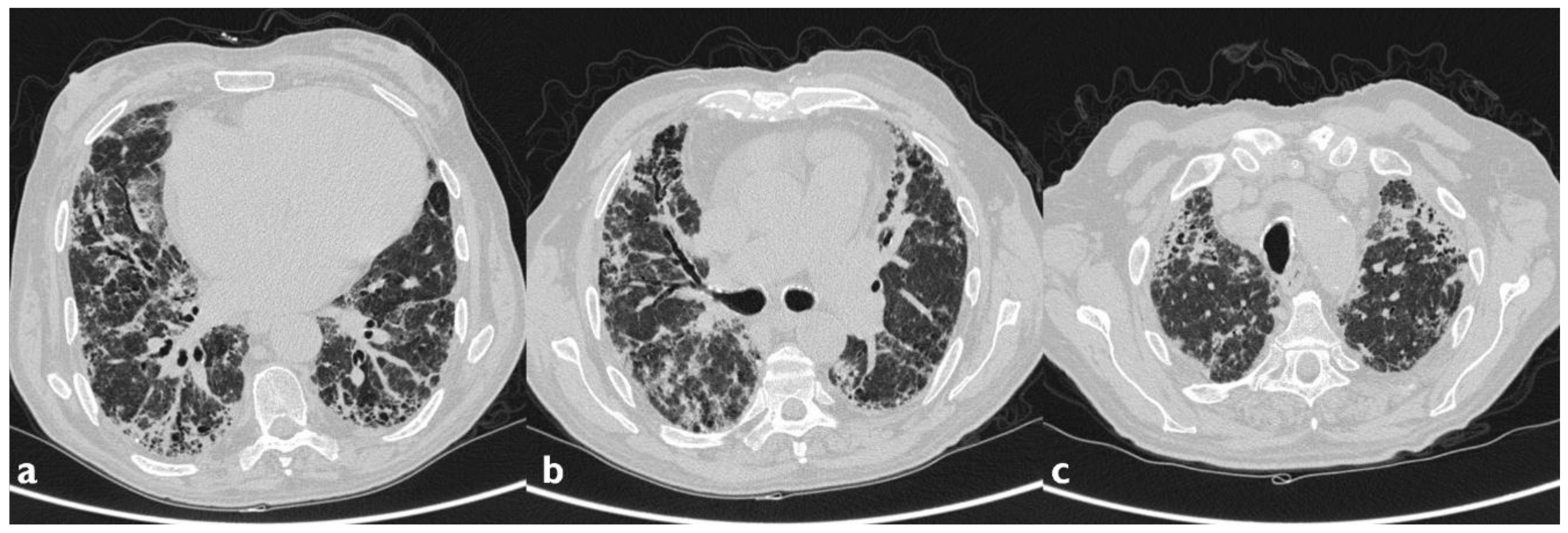 Diagnostics 10 00244 g007