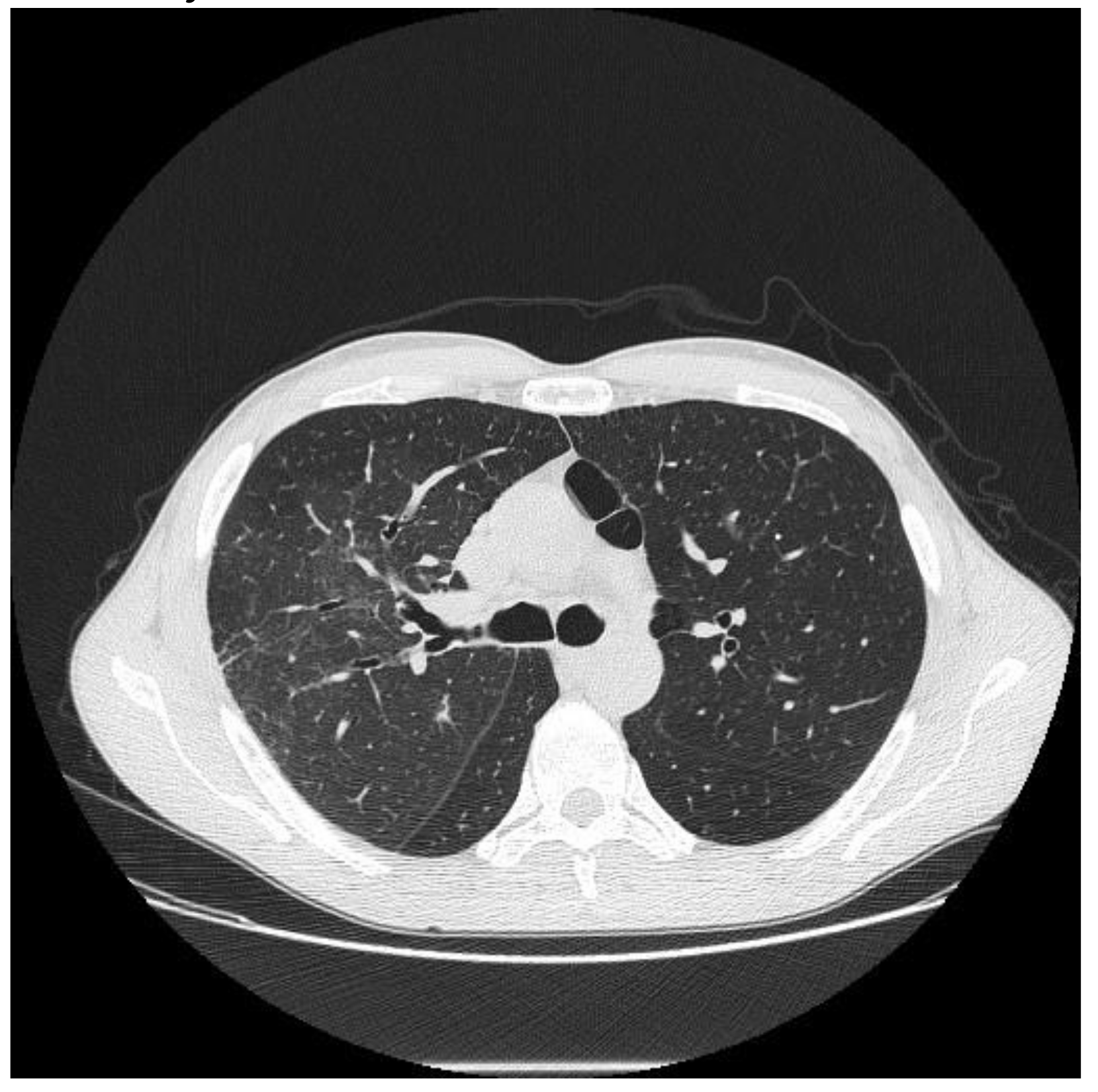 Diagnostics 10 00244 g009