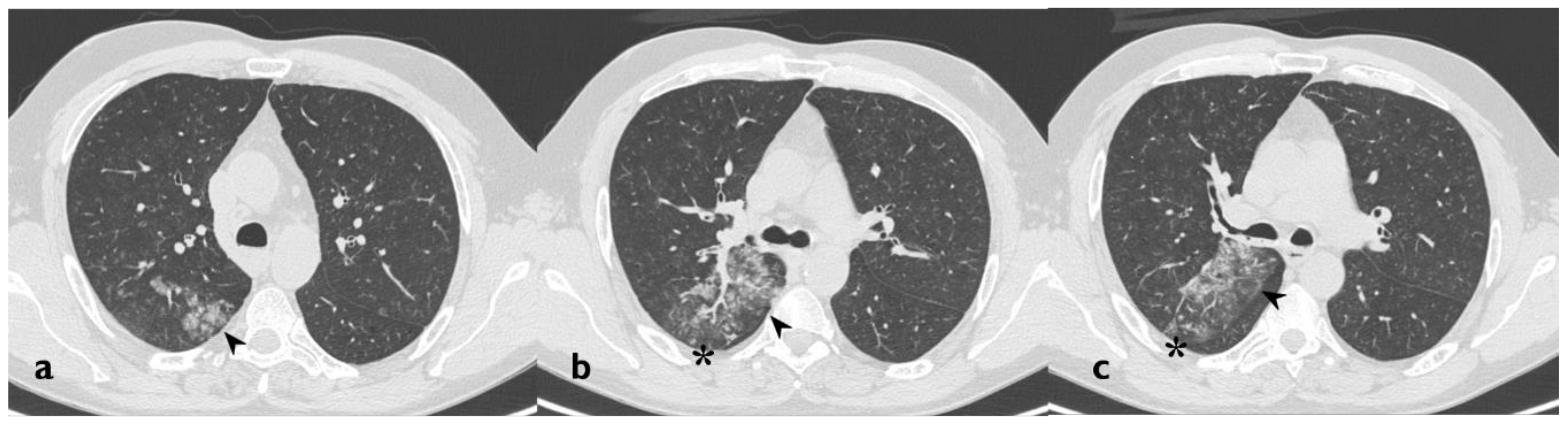 Diagnostics 10 00244 g010