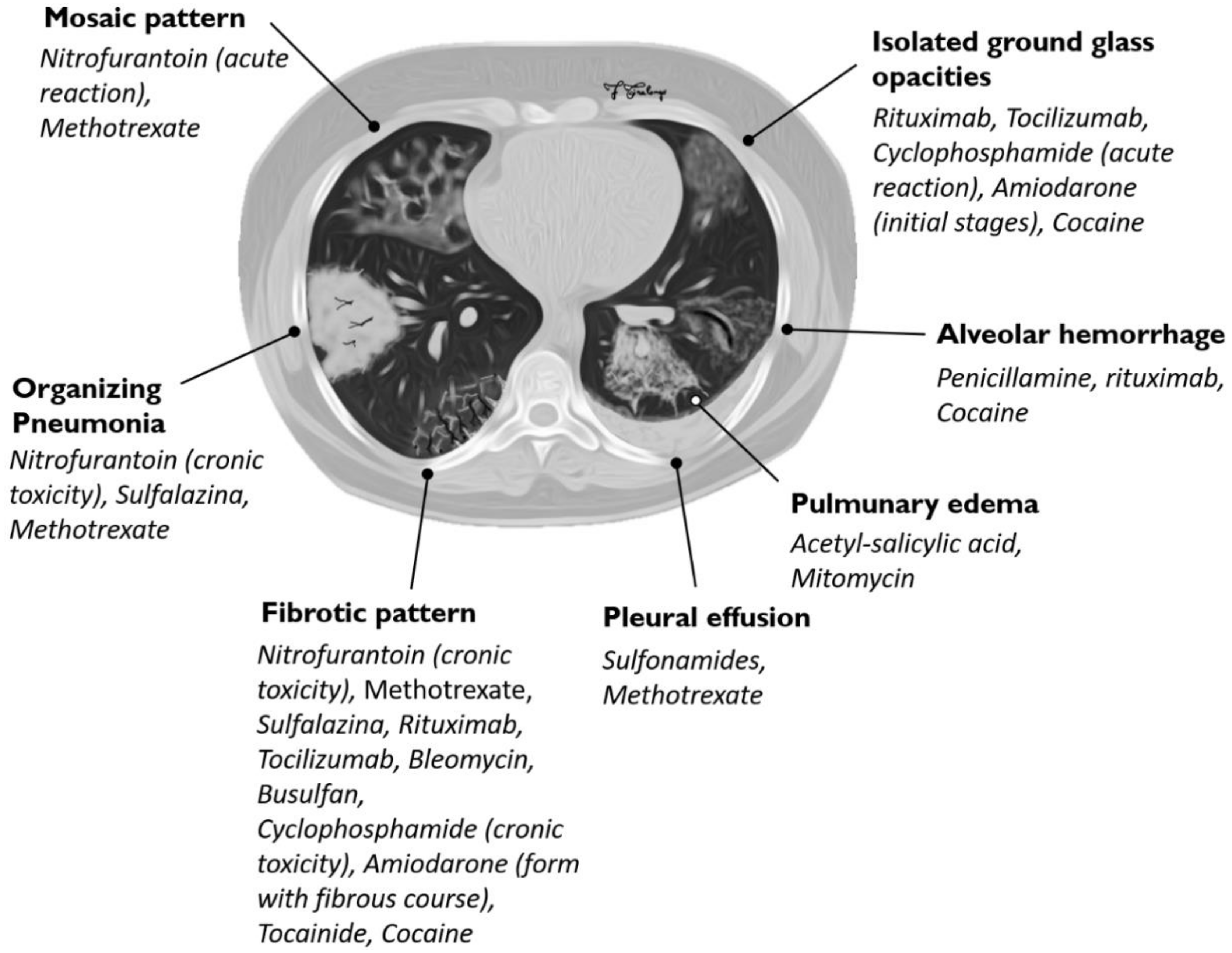Diagnostics 10 00244 g011