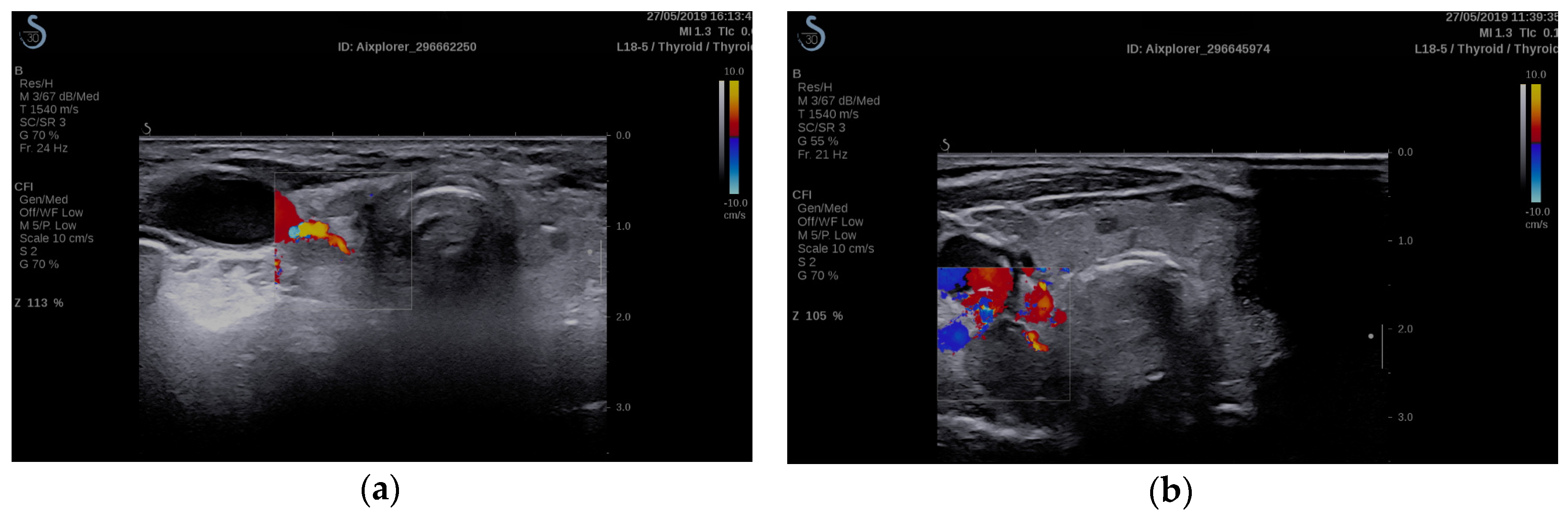Diagnostics 10 00245 g001