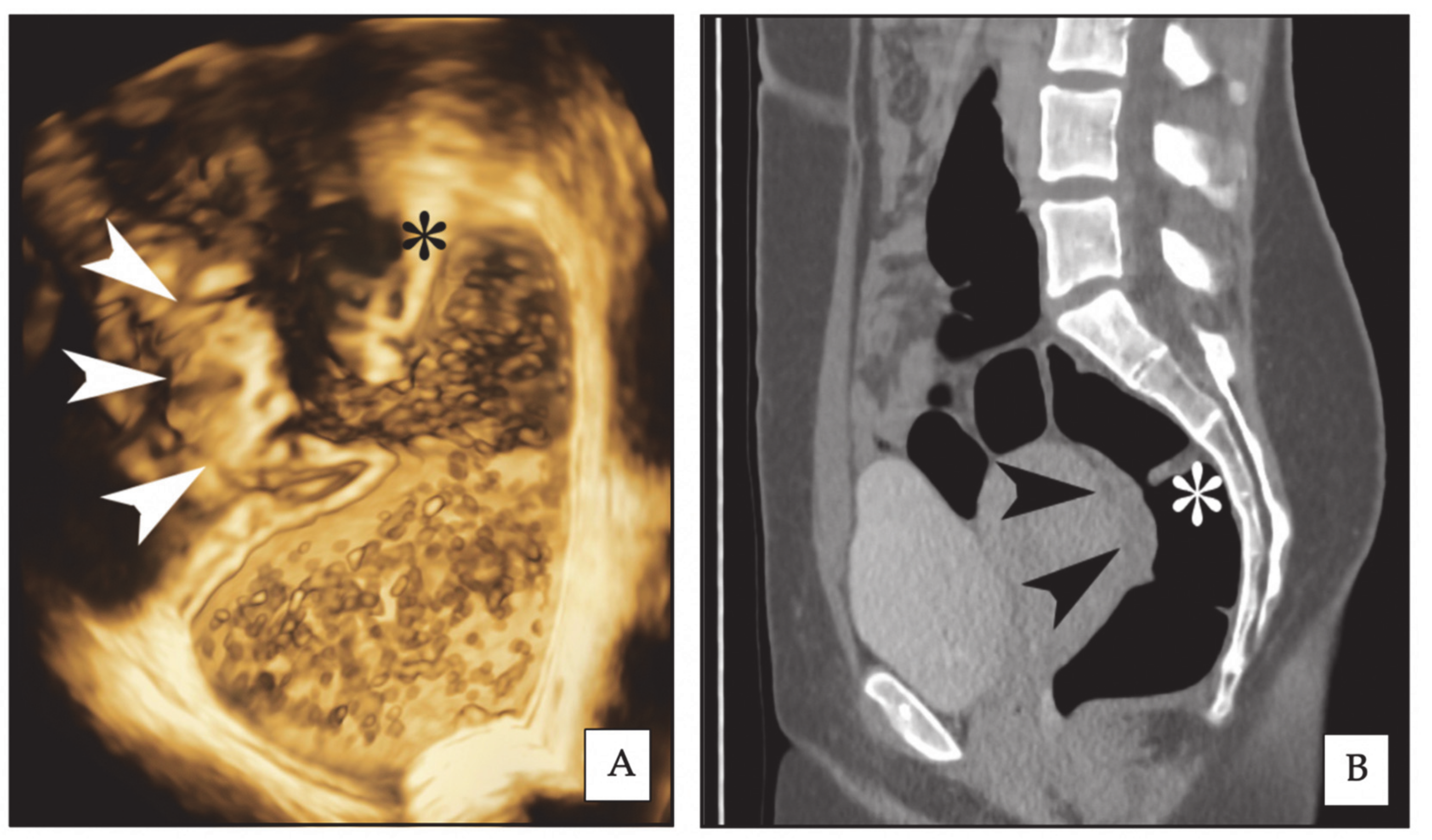 Diagnostics 10 00252 g001 Diagnostics 10 00252 g001