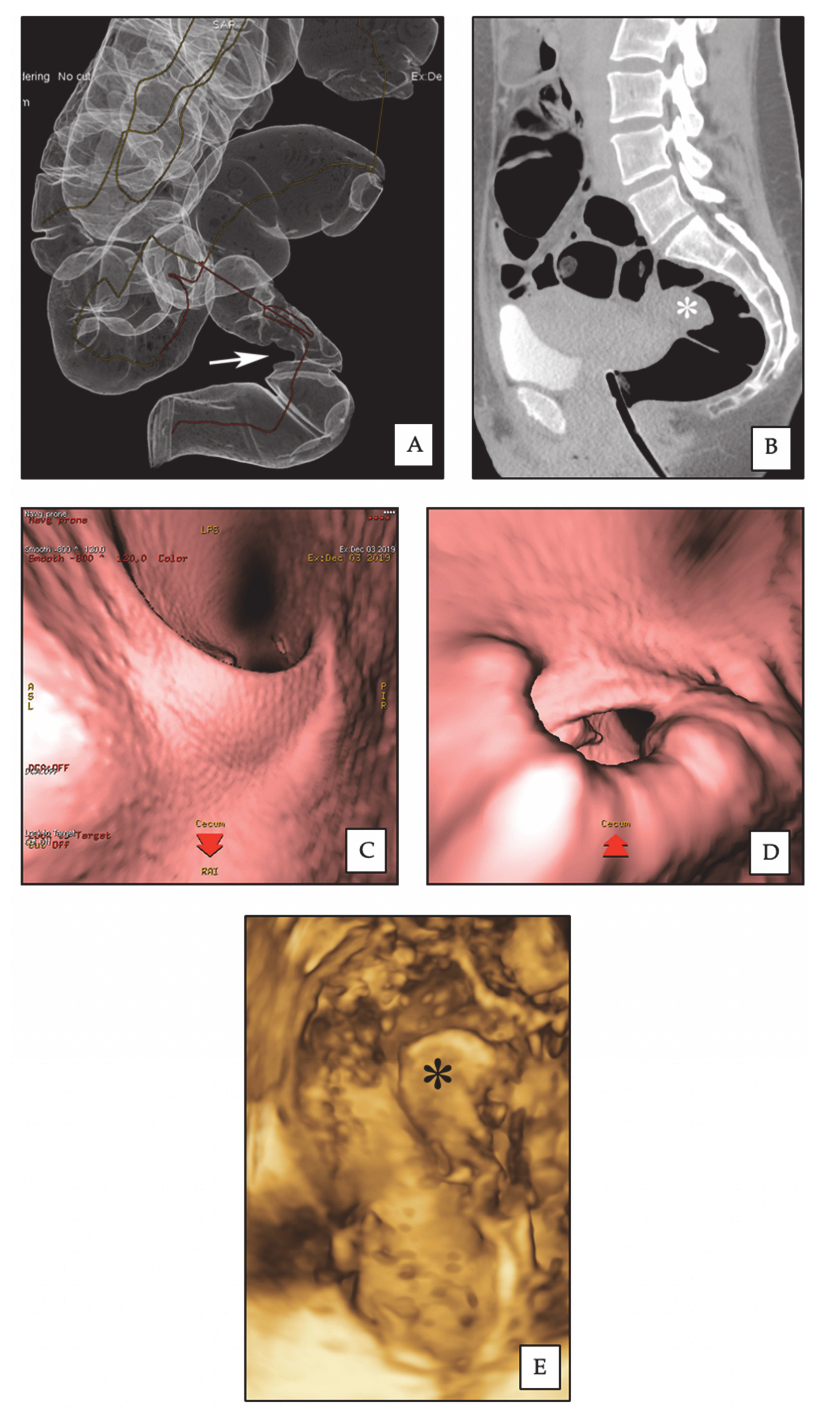 Diagnostics 10 00252 g002 Diagnostics 10 00252 g002