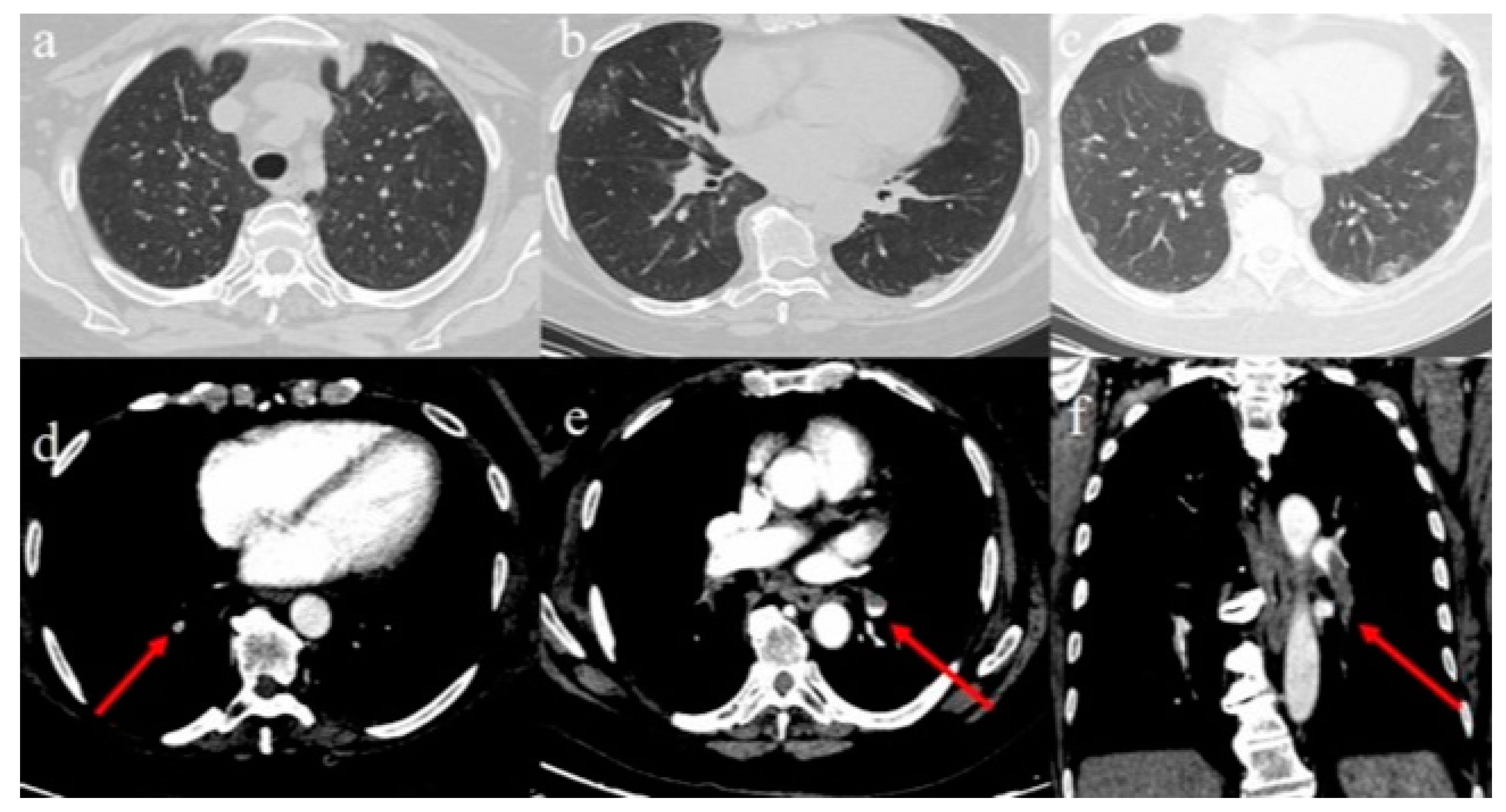 Diagnostics 10 00283 g001