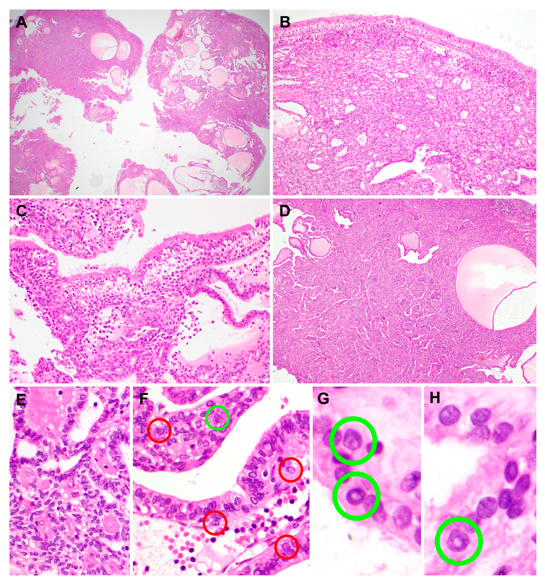 Diagnostics 10 00323 g002