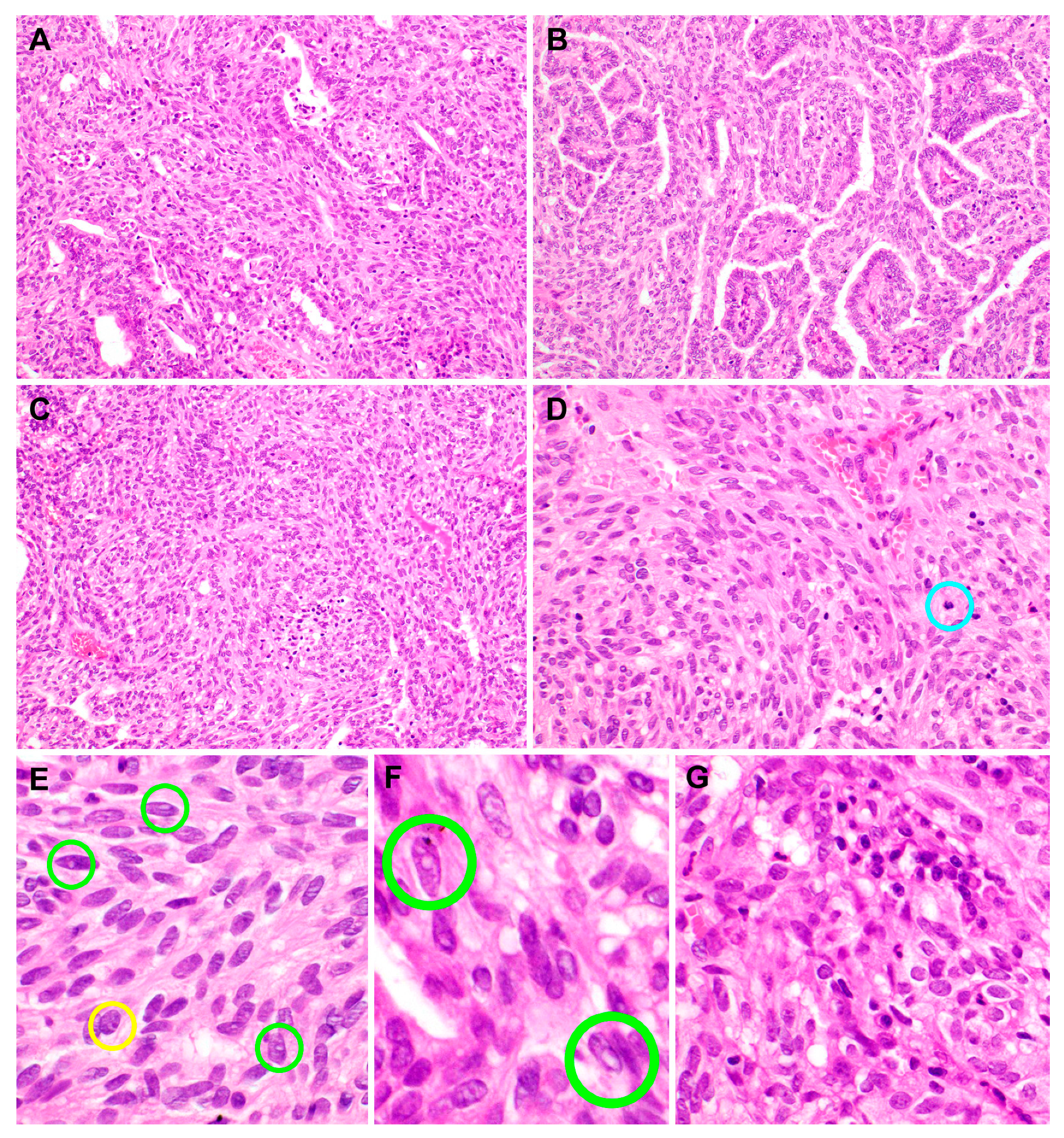 Diagnostics 10 00323 g003