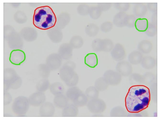 Diagnostics 10 00329 g0a1
