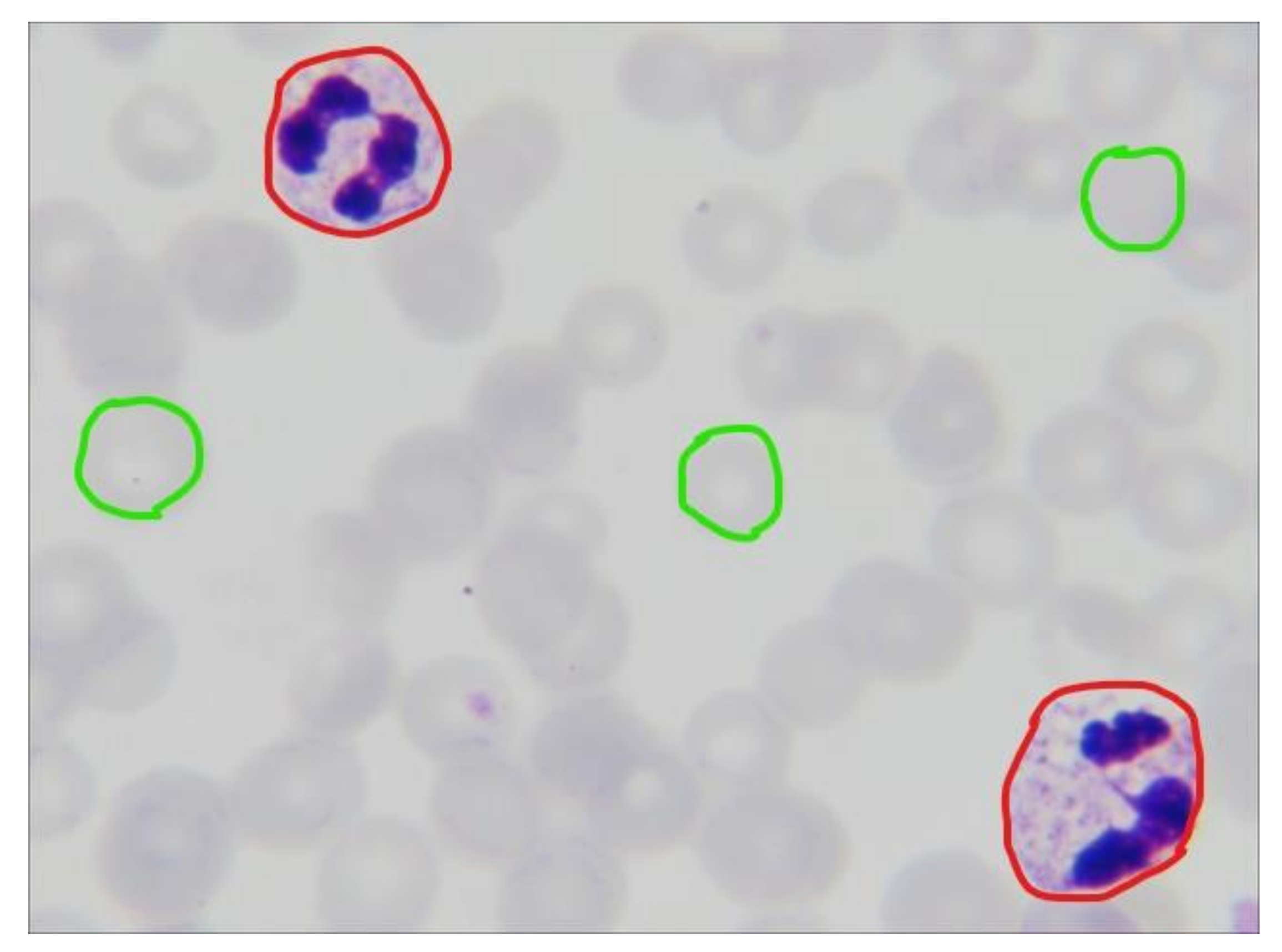 Diagnostics 10 00329 g0a1
