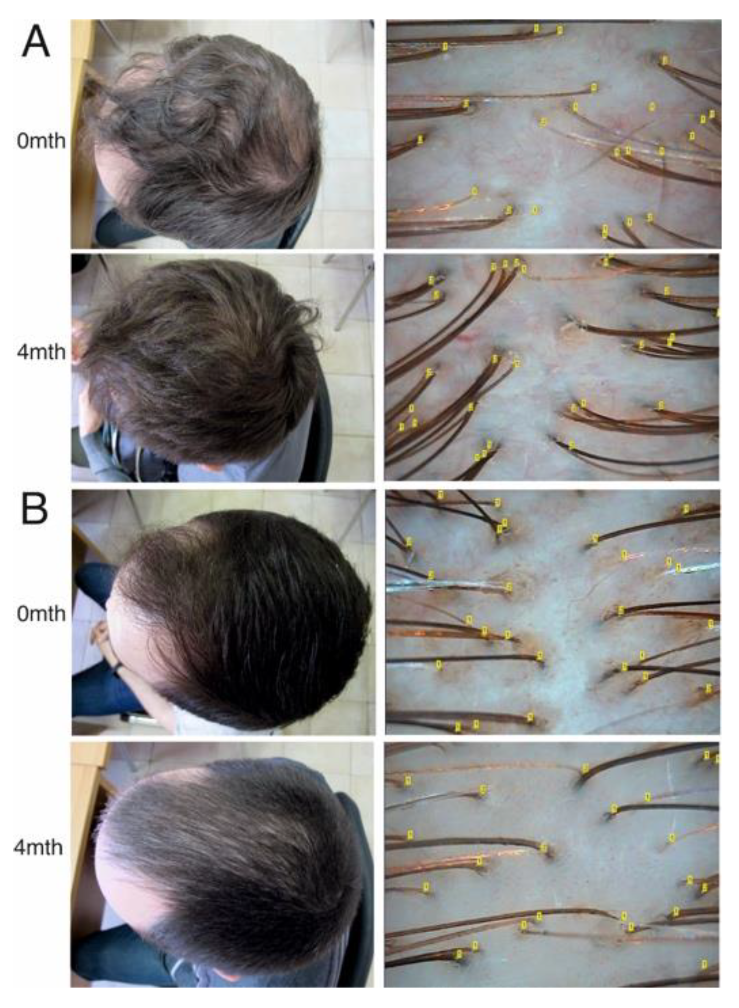 Diagnostics 10 00336 g001
