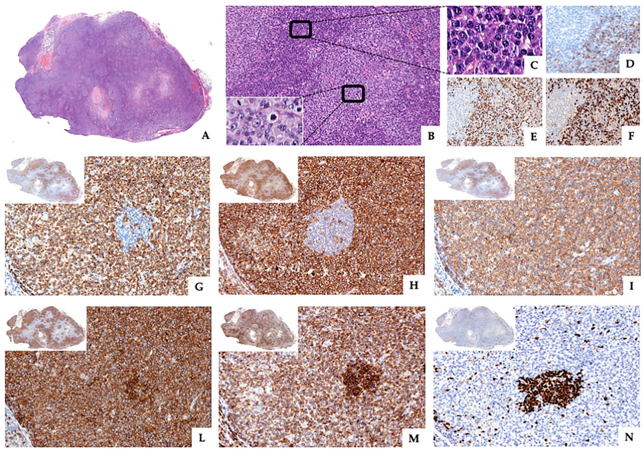 Diagnostics 10 00341 g001