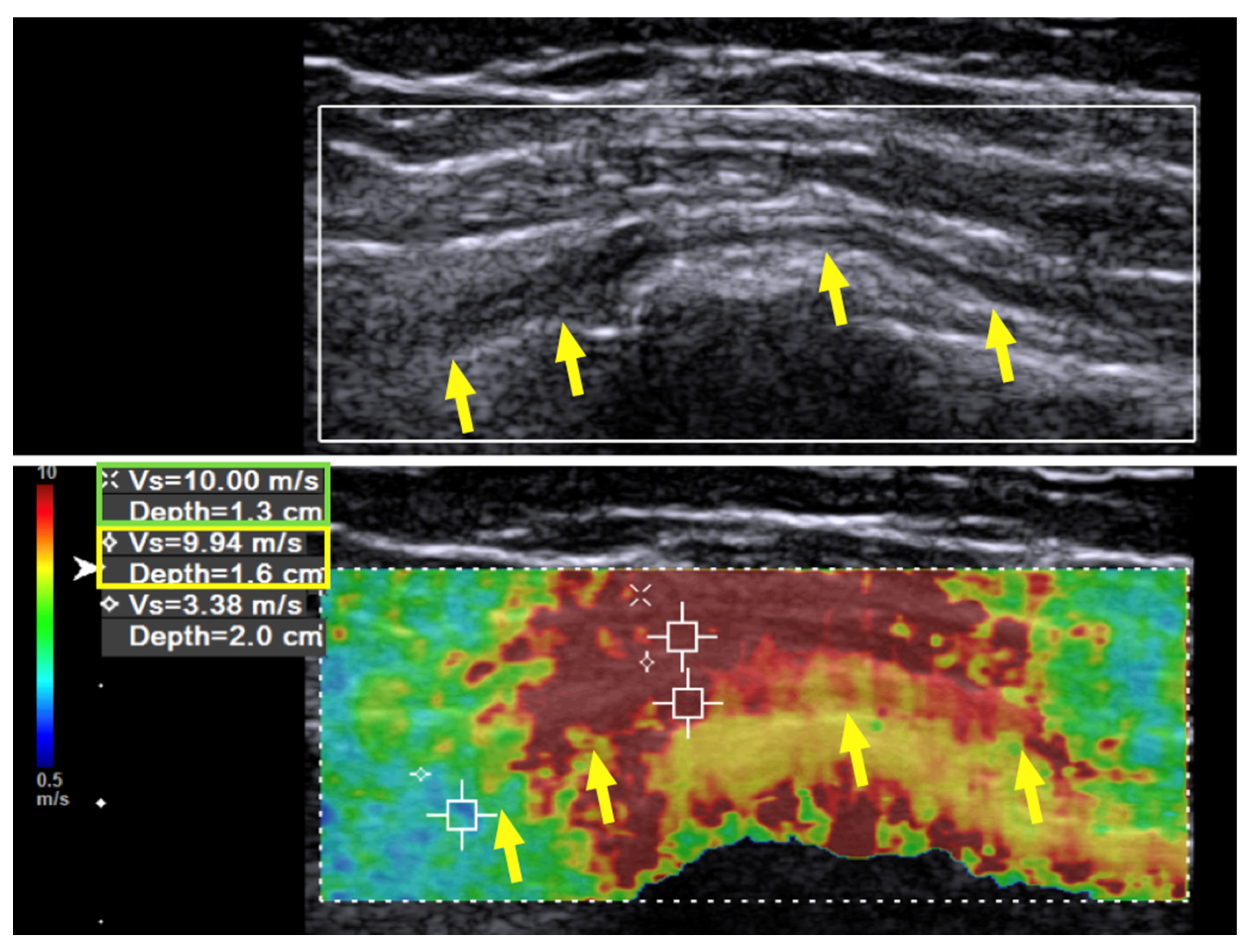 Diagnostics 10 00348 g001