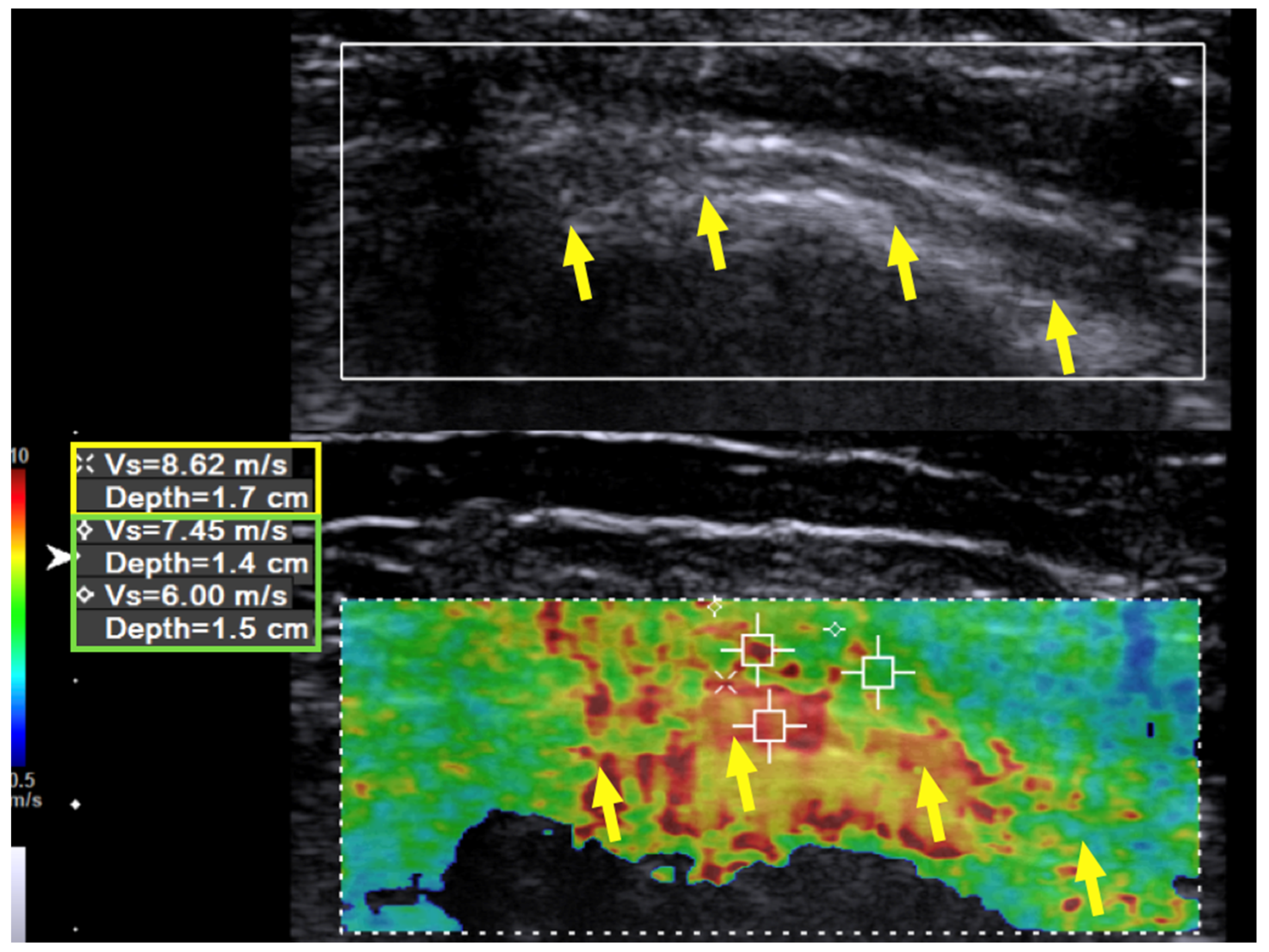 Diagnostics 10 00348 g003