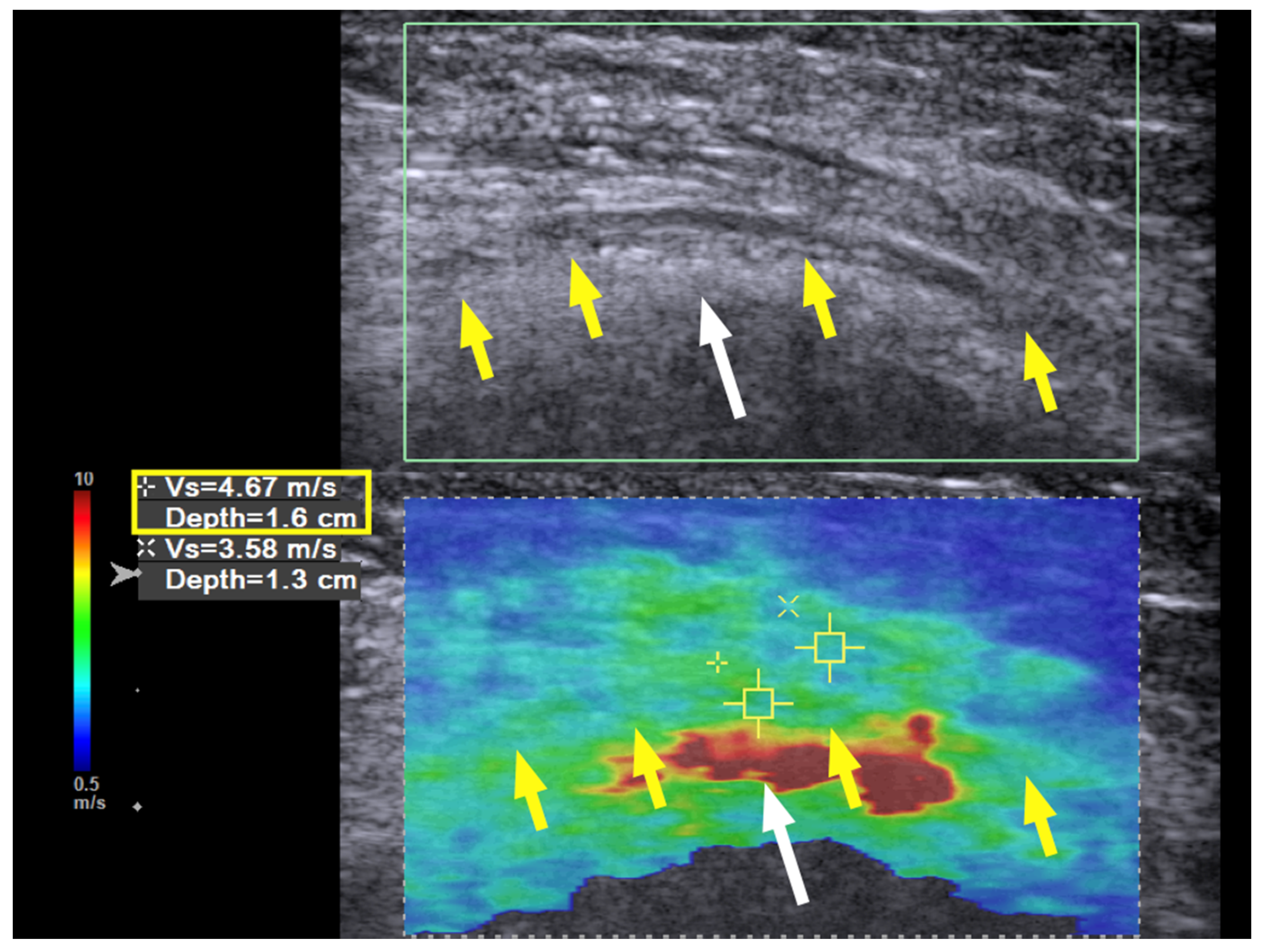Diagnostics 10 00348 g004