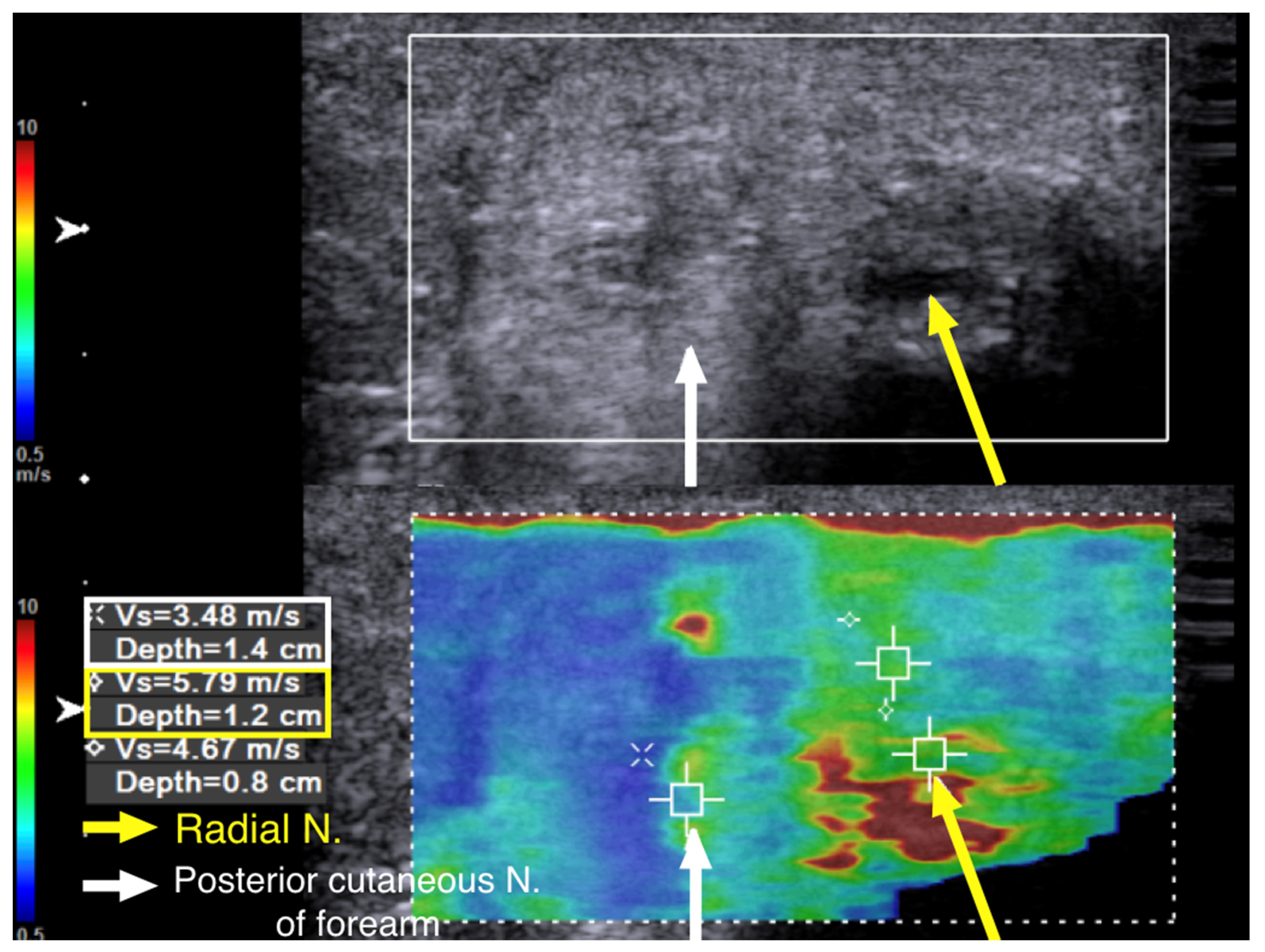 Diagnostics 10 00348 g006