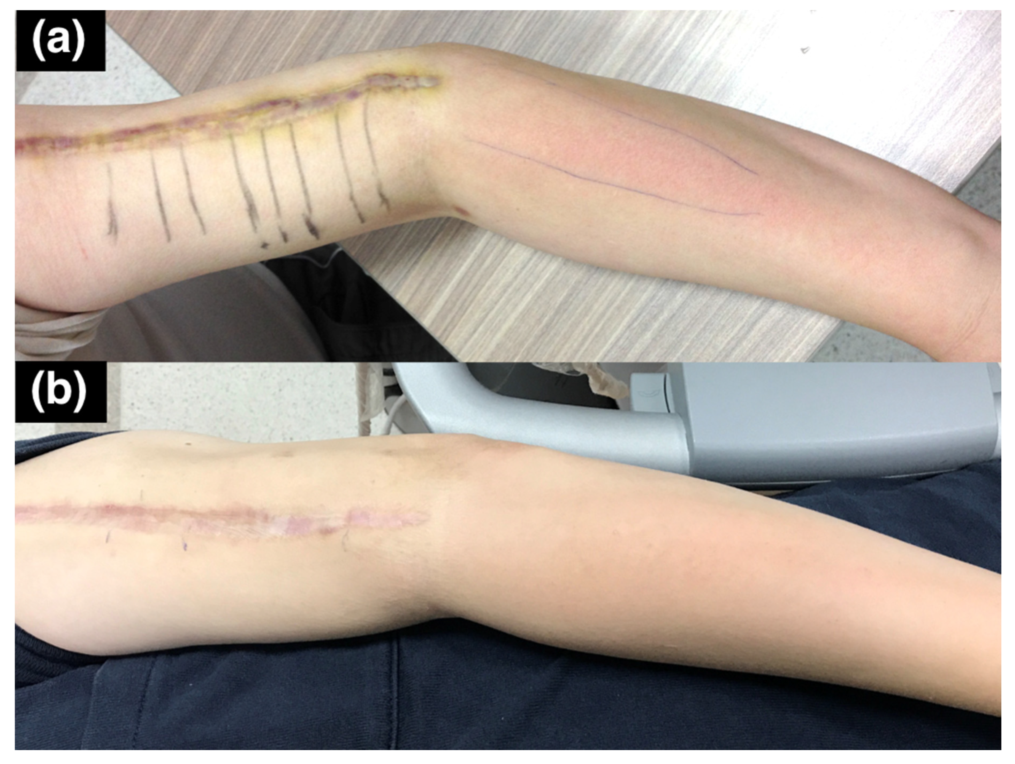 Diagnostics 10 00348 g007