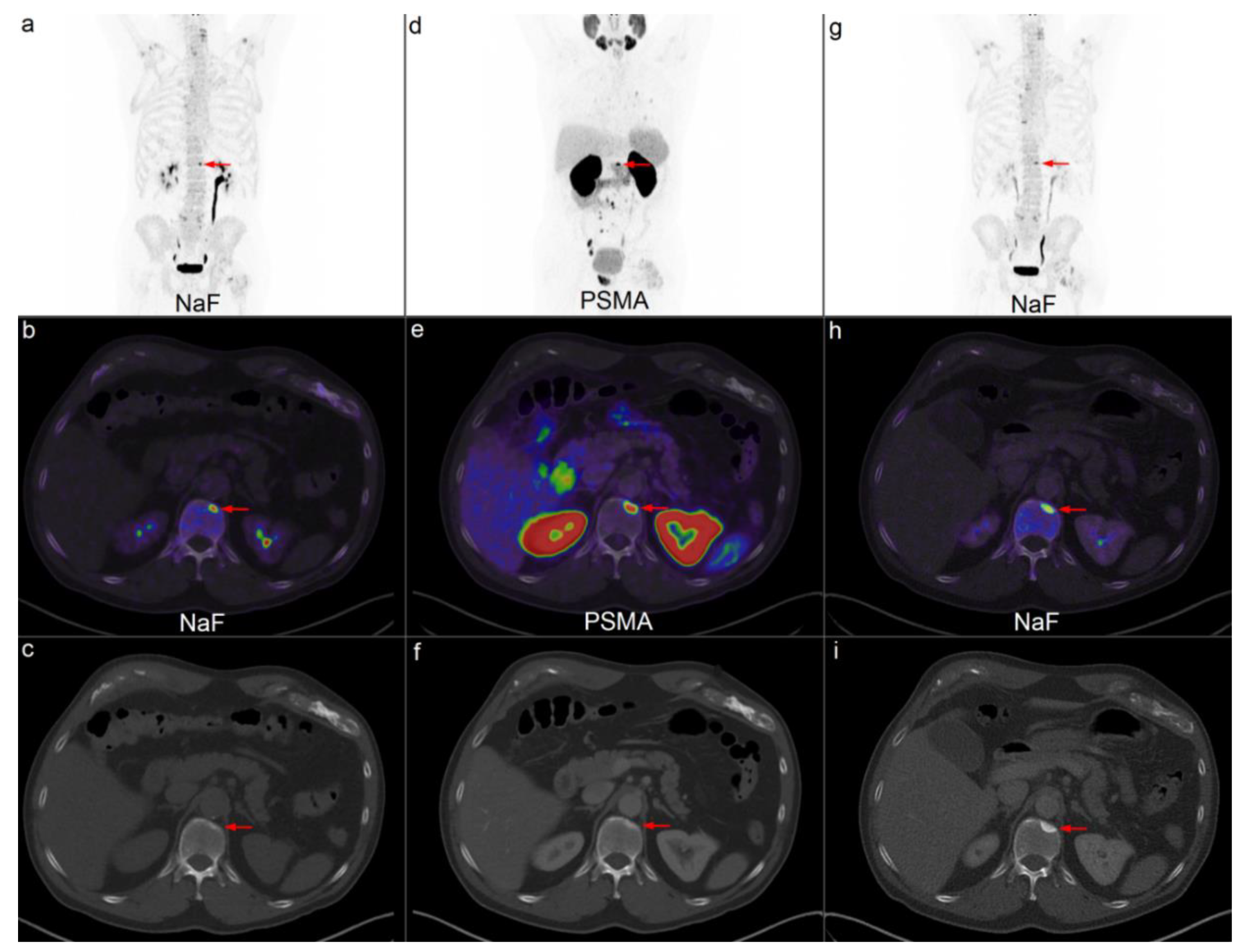 Diagnostics 10 00352 g001