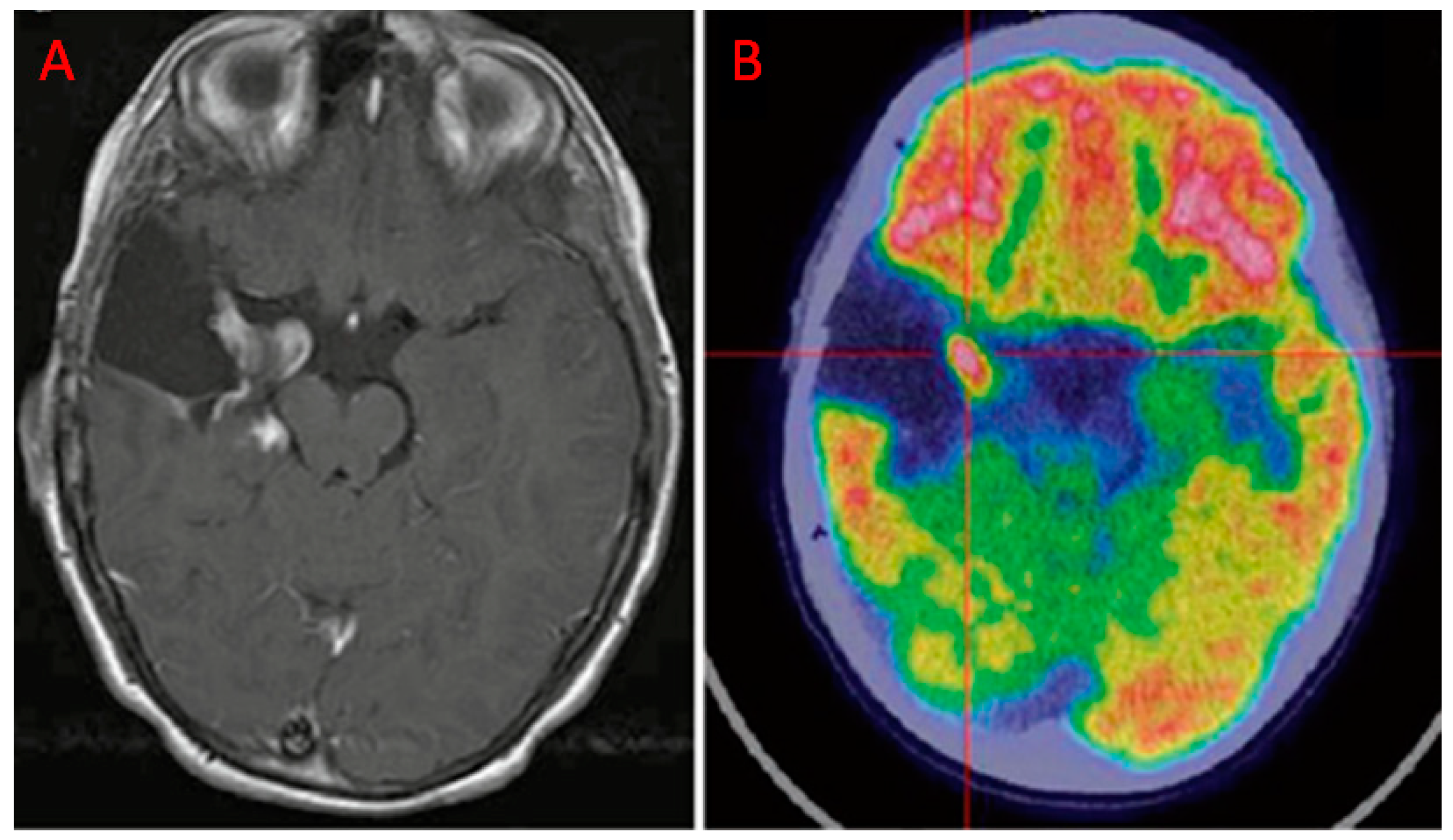 Diagnostics 10 00357 g003