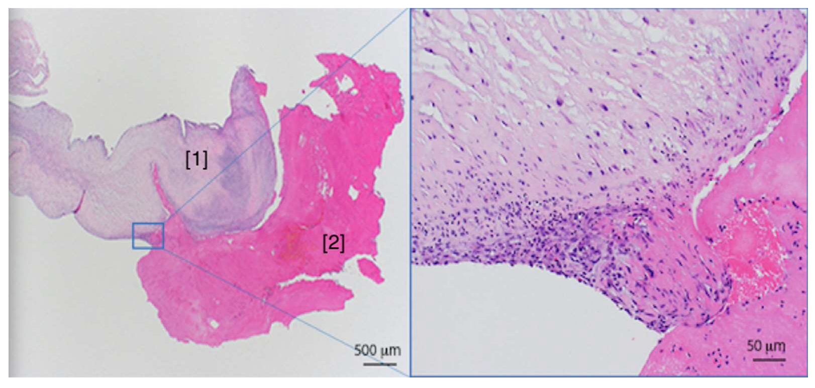 Diagnostics 10 00384 g004 Diagnostics 10 00384 g004