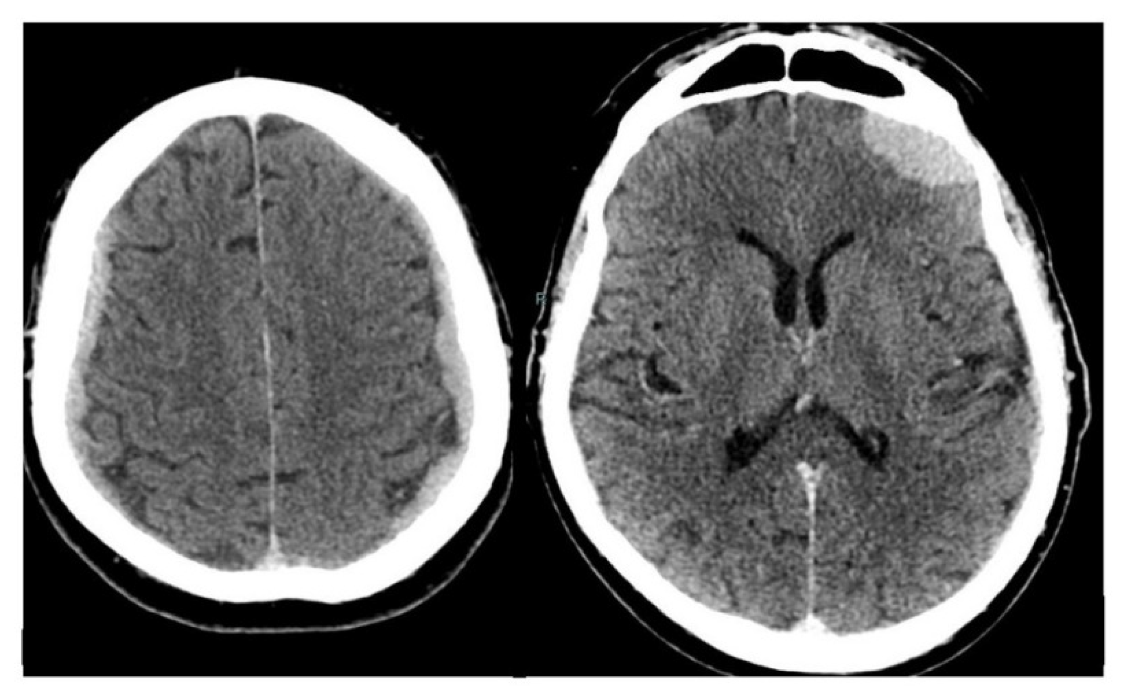 Diagnostics 10 00385 g002