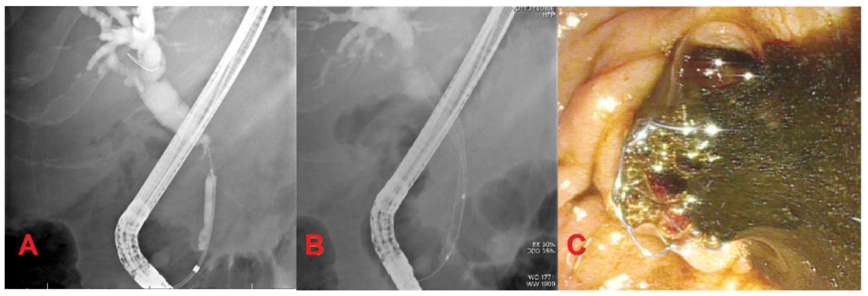 Diagnostics 10 00390 g001 Diagnostics 10 00390 g001
