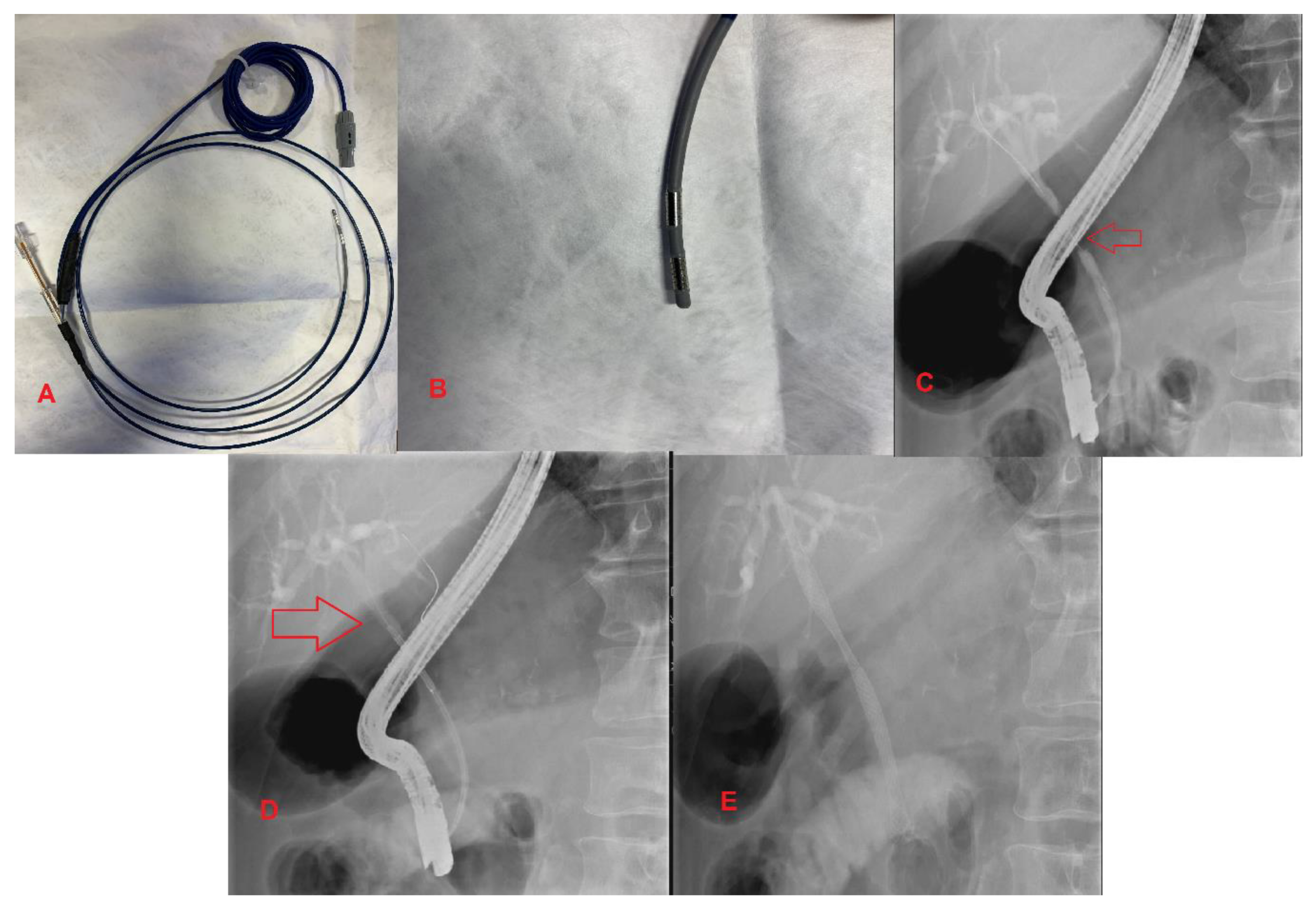Diagnostics 10 00390 g003 Diagnostics 10 00390 g003