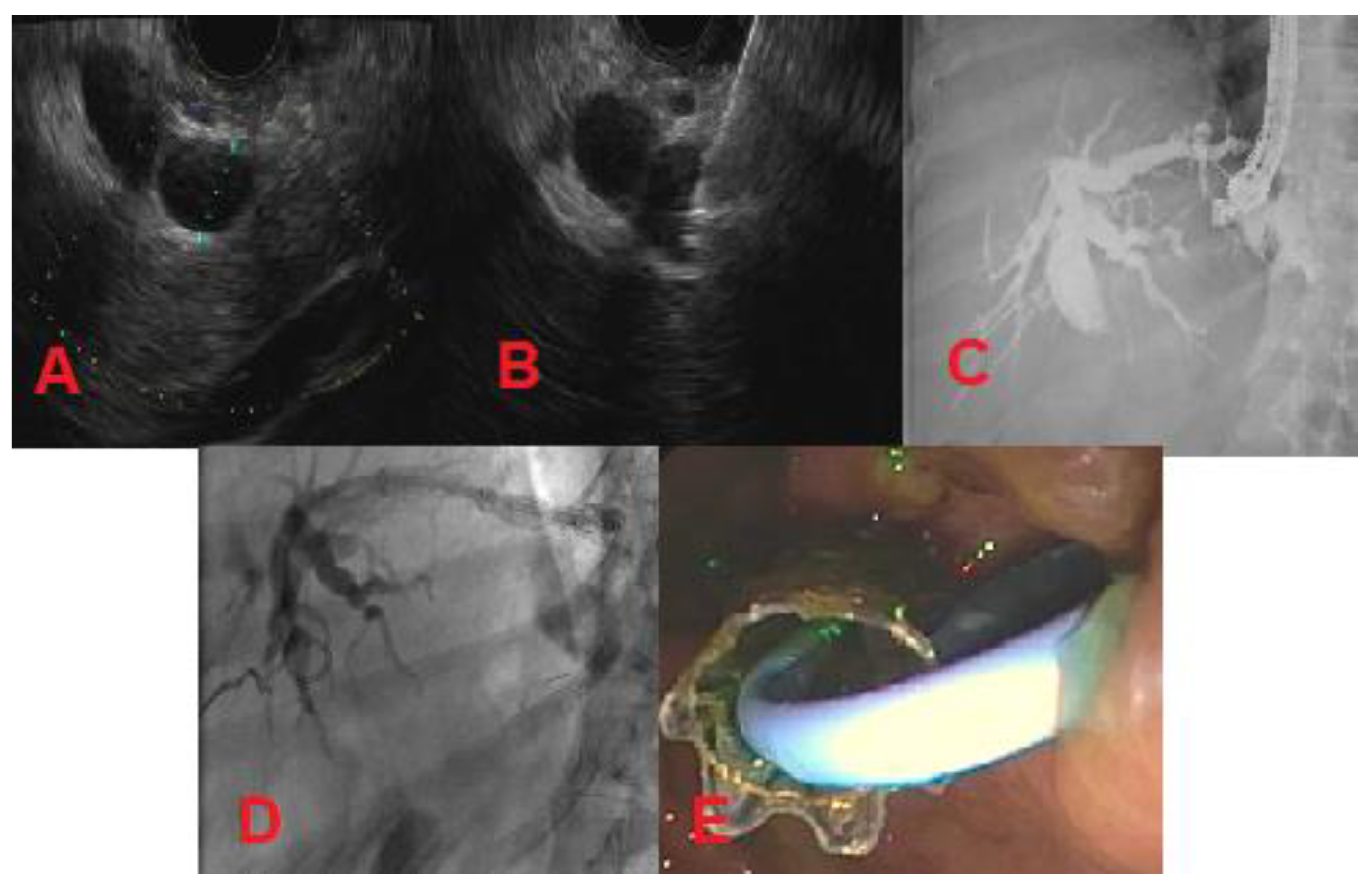 Diagnostics 10 00390 g004 Diagnostics 10 00390 g004