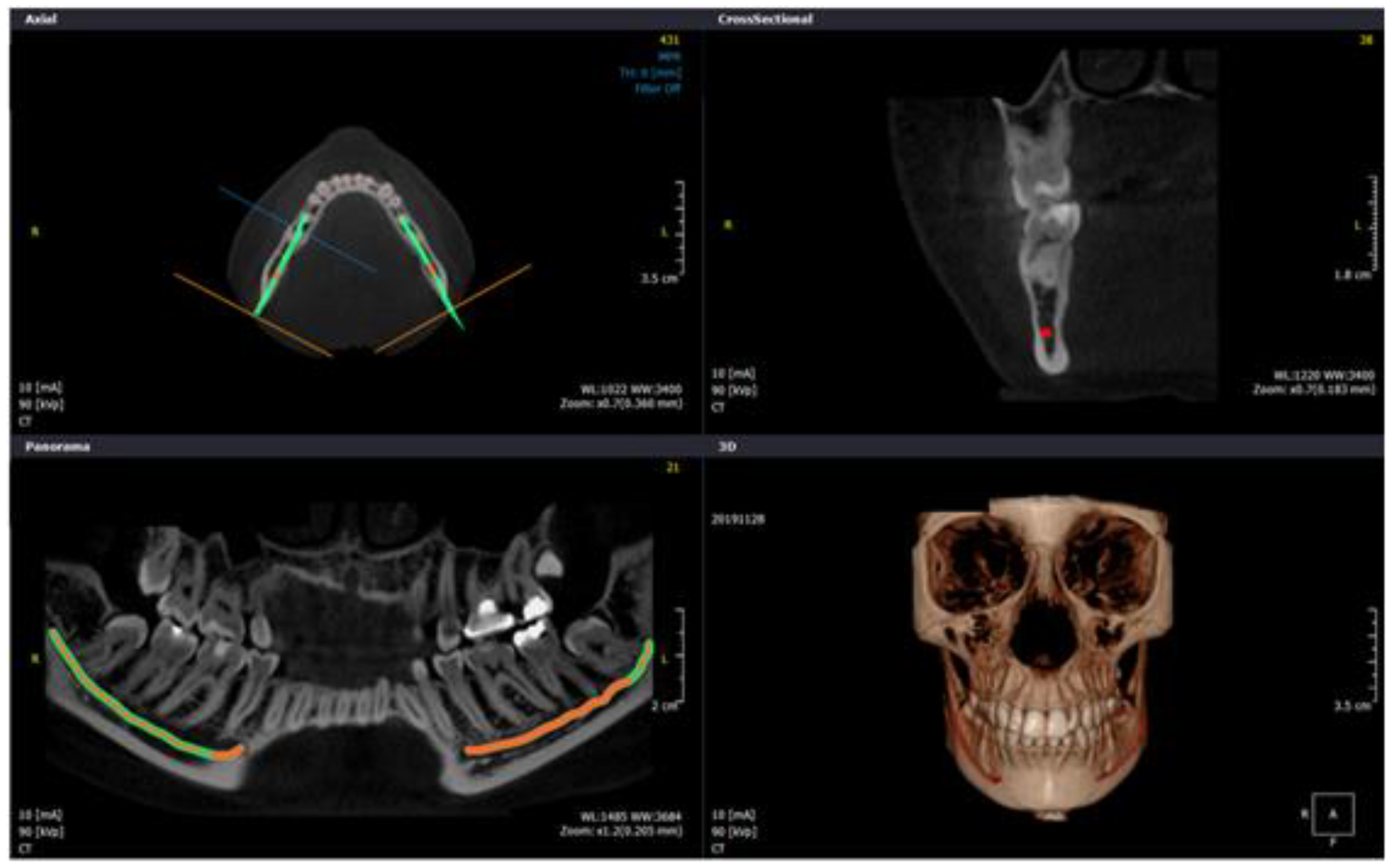 Diagnostics 10 00406 g005