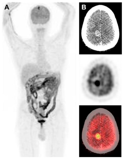 Diagnostics 10 00410 g002