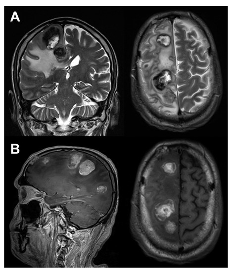 Diagnostics 10 00410 g003