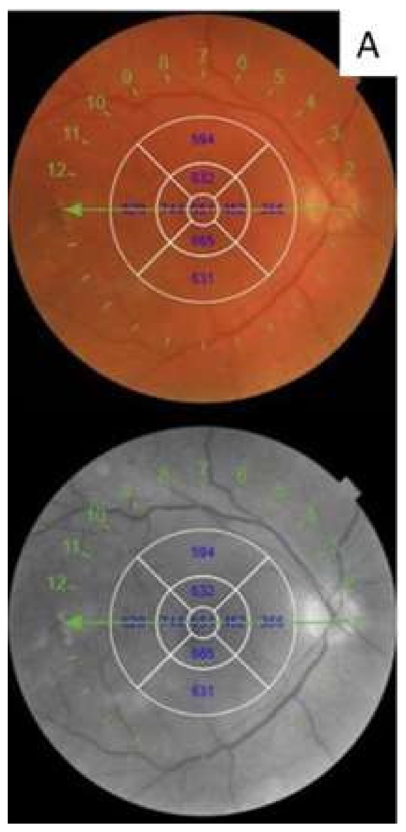 Diagnostics 10 00413 g001a