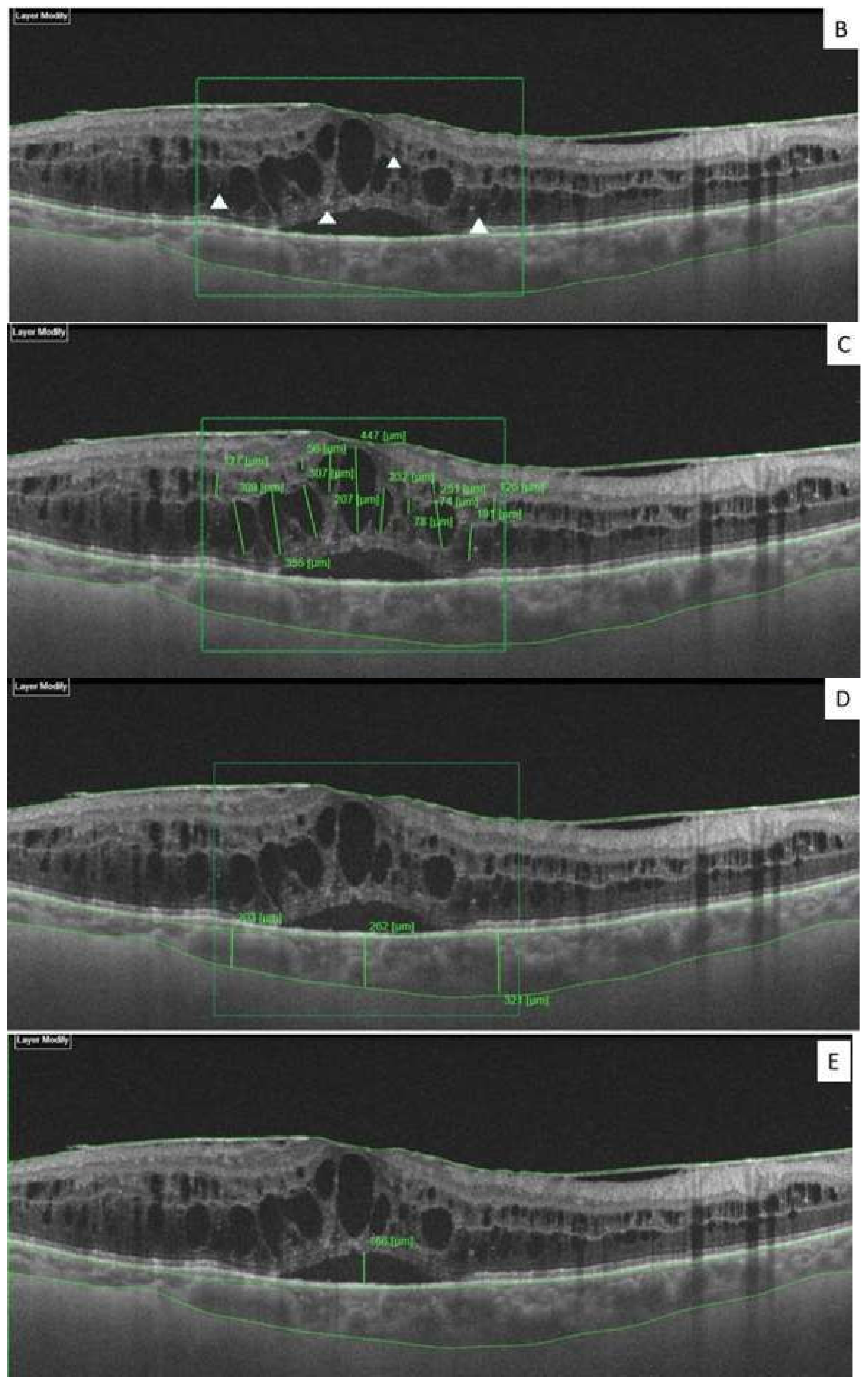 Diagnostics 10 00413 g001b
