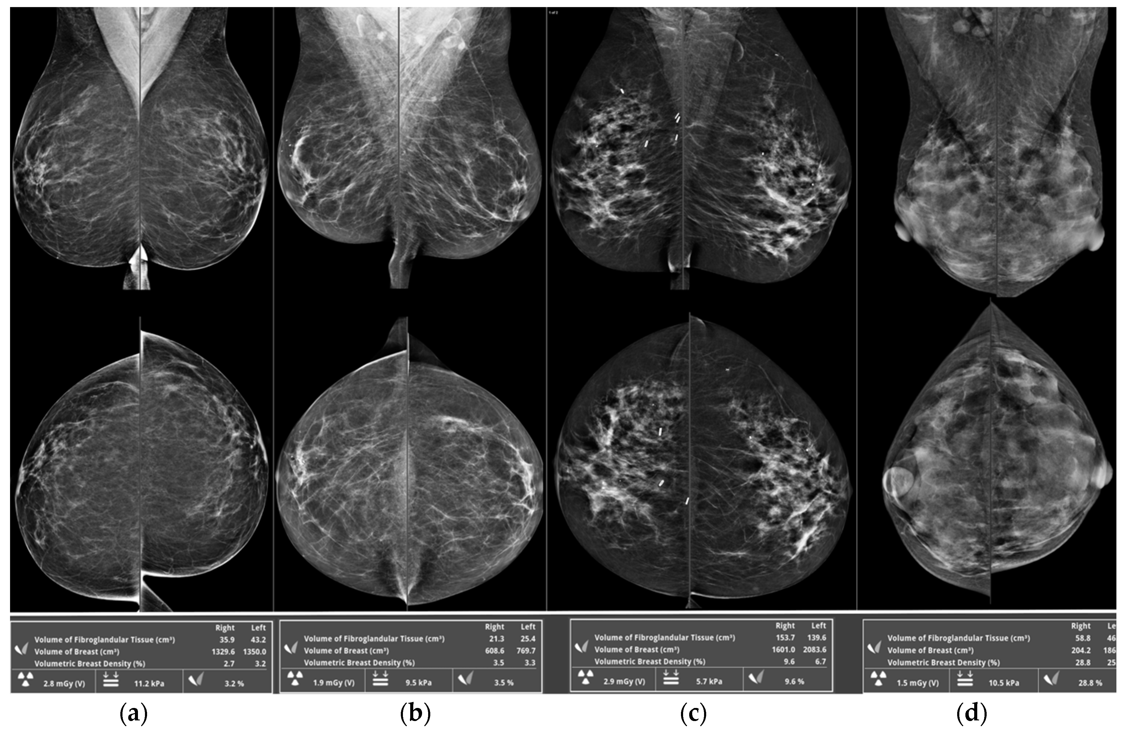 Diagnostics 10 00418 g001