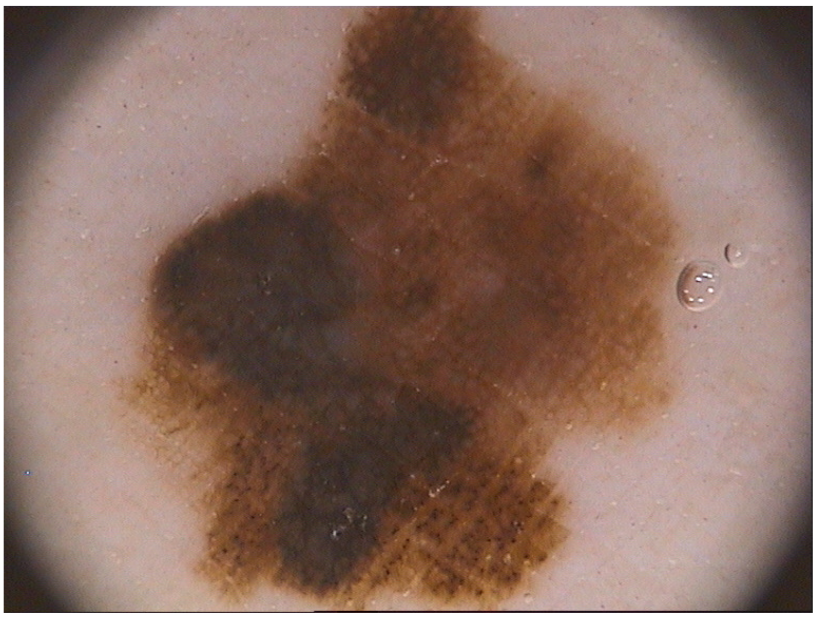 Diagnostics 10 00423 g001 Diagnostics 10 00423 g001