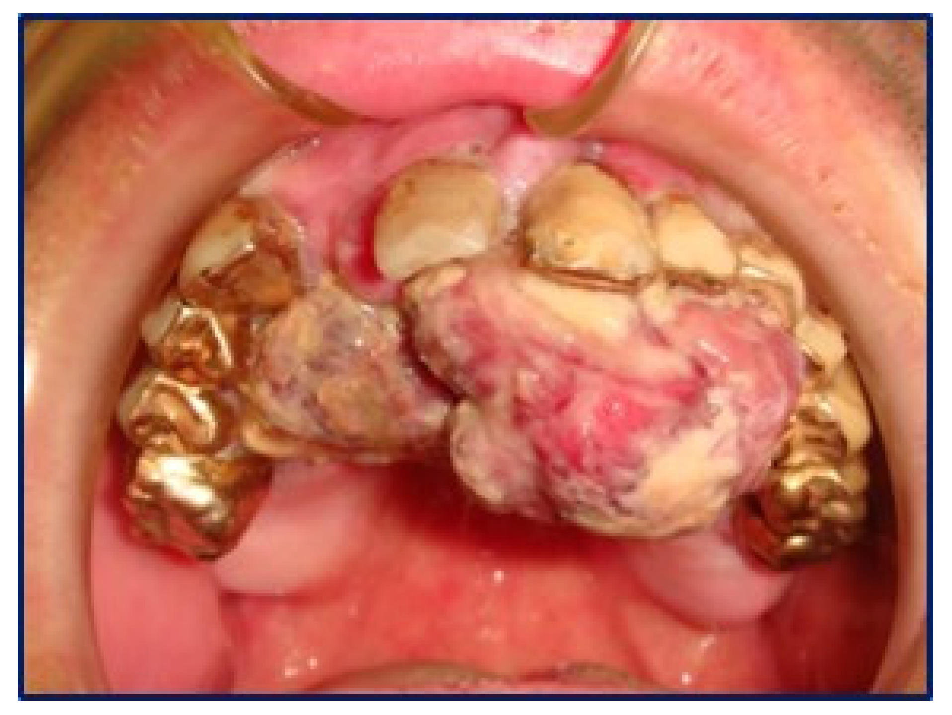 Diagnostics 10 00424 g001