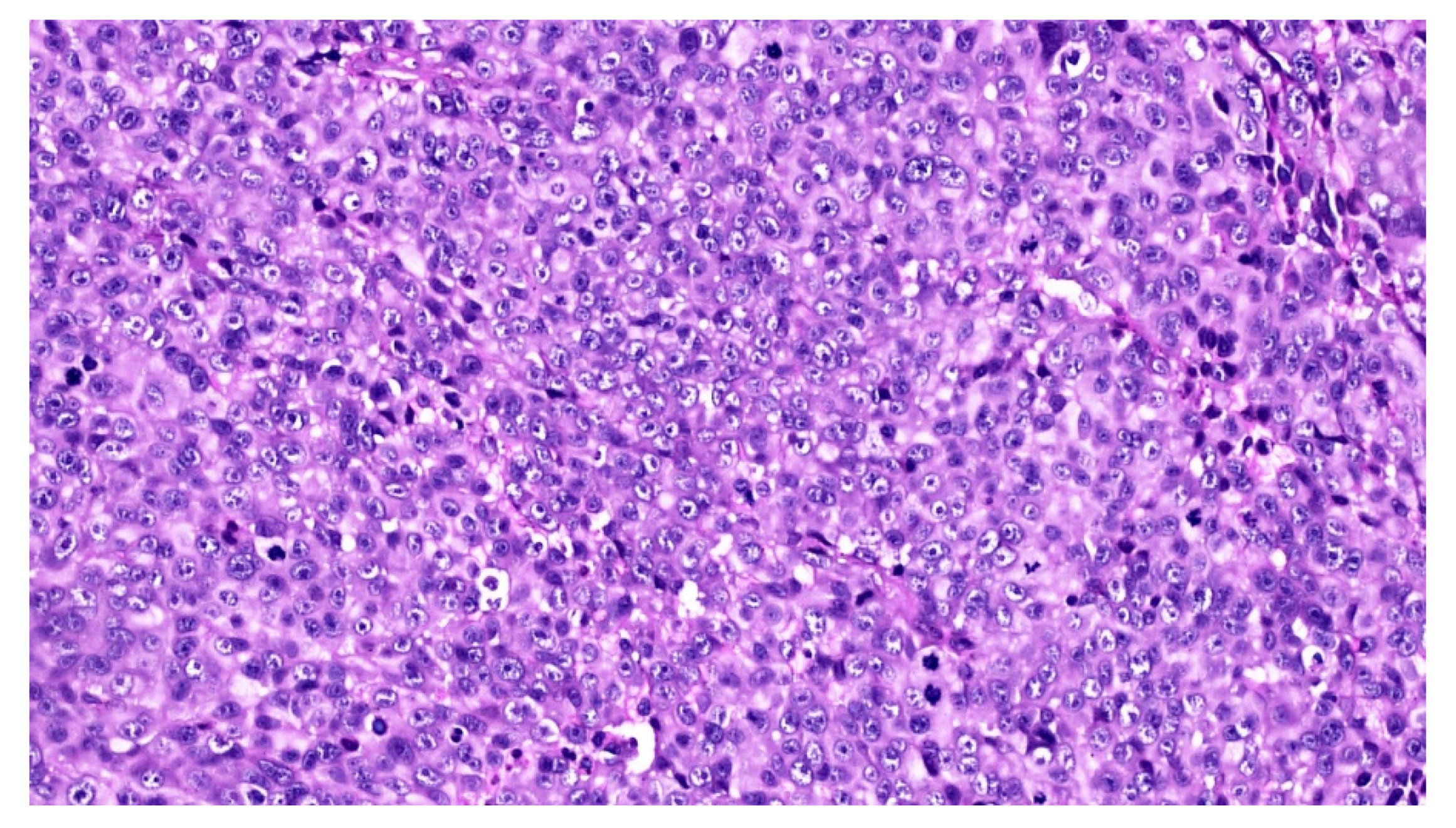 Diagnostics 10 00424 g005