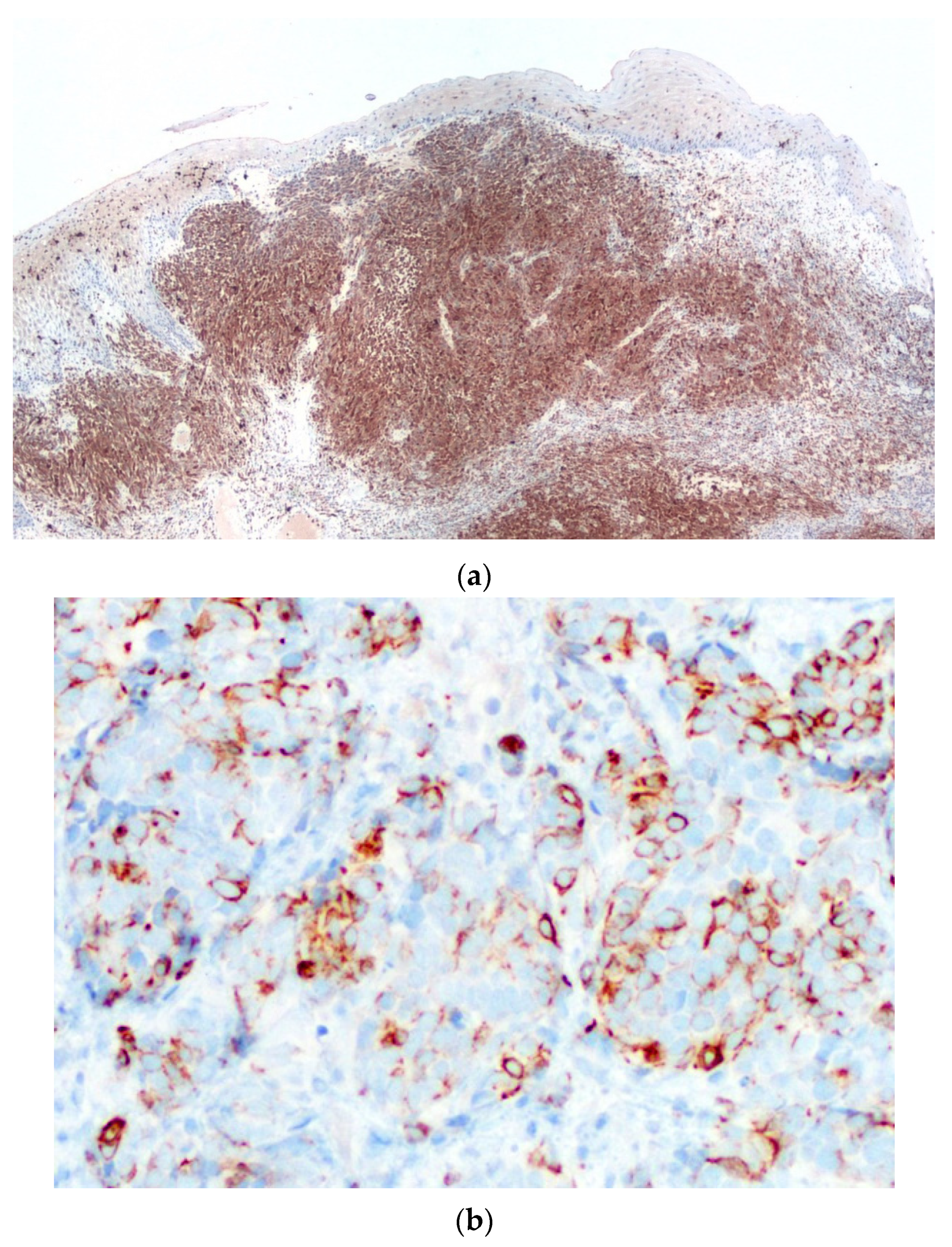 Diagnostics 10 00424 g006a