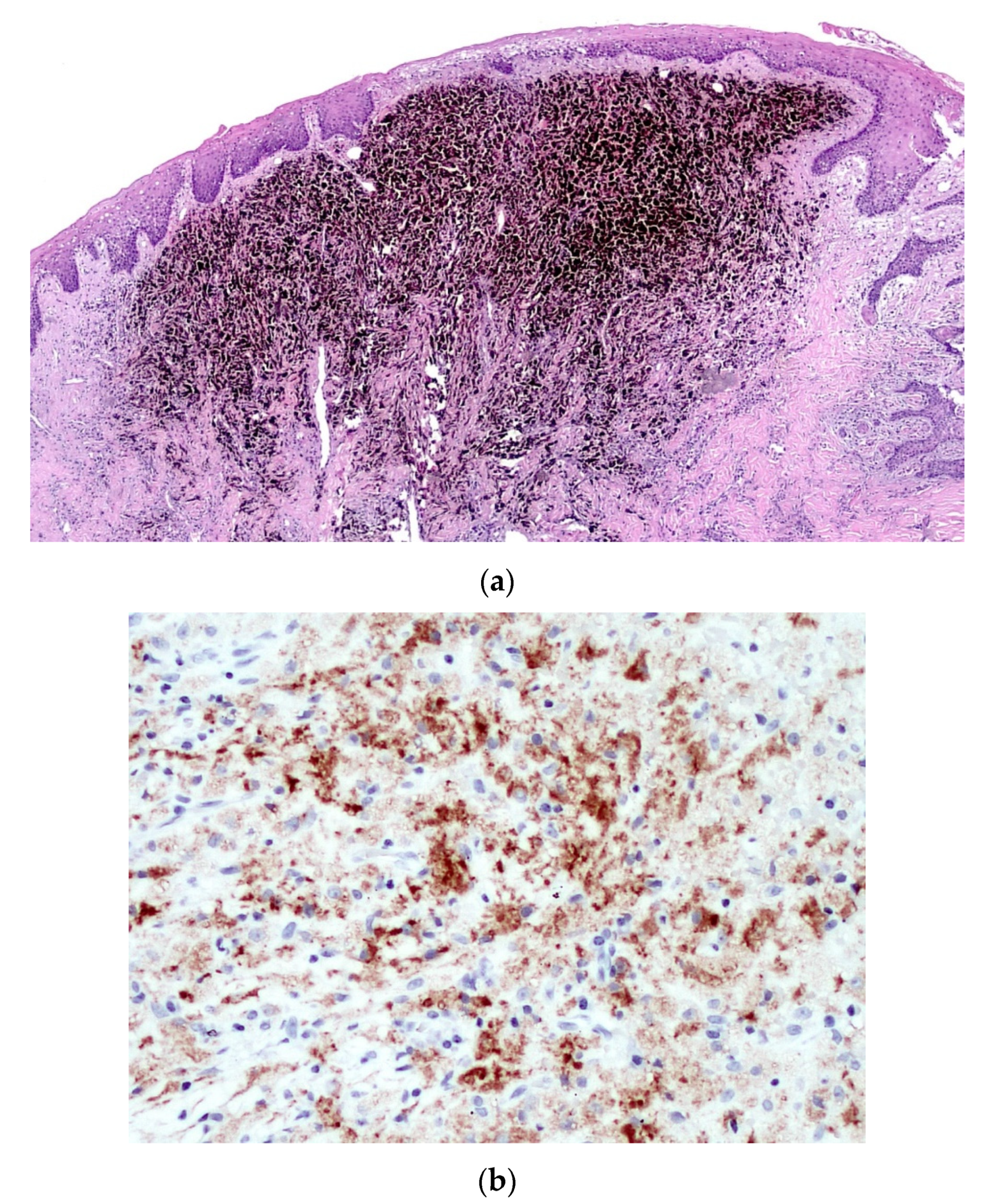 Diagnostics 10 00424 g007