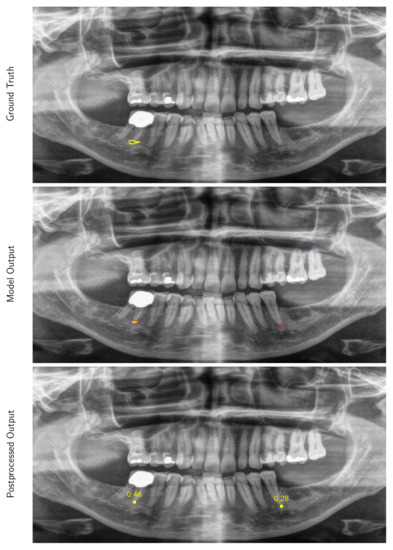 Diagnostics 10 00430 g0a3